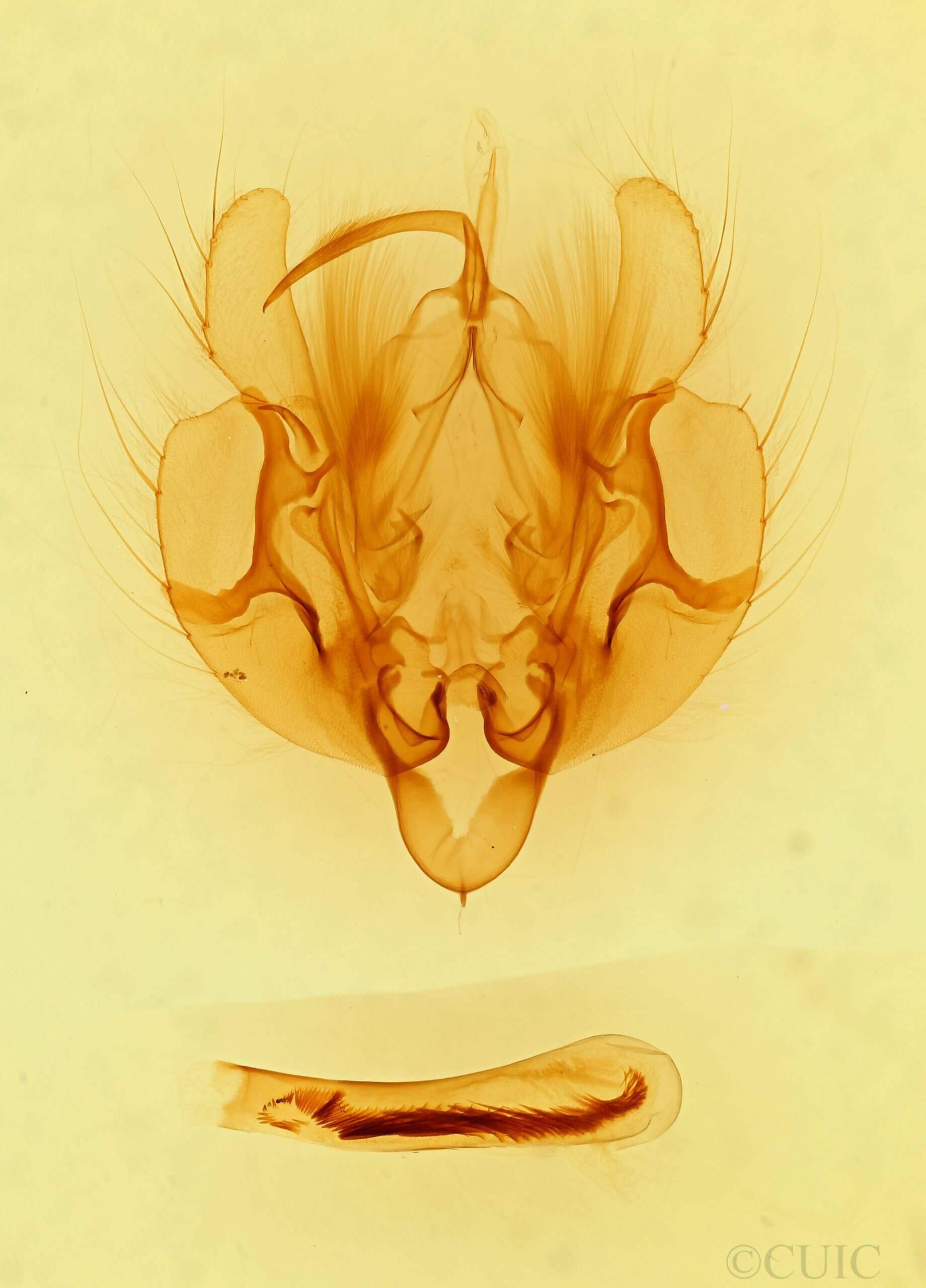genitalia view of adult Leucania imperfecta