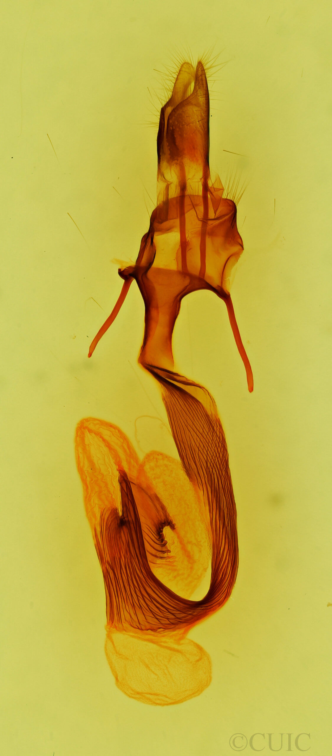 genitalia view of adult Leucania imperfecta