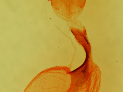 genitalia view of adult Lithophane tarda
