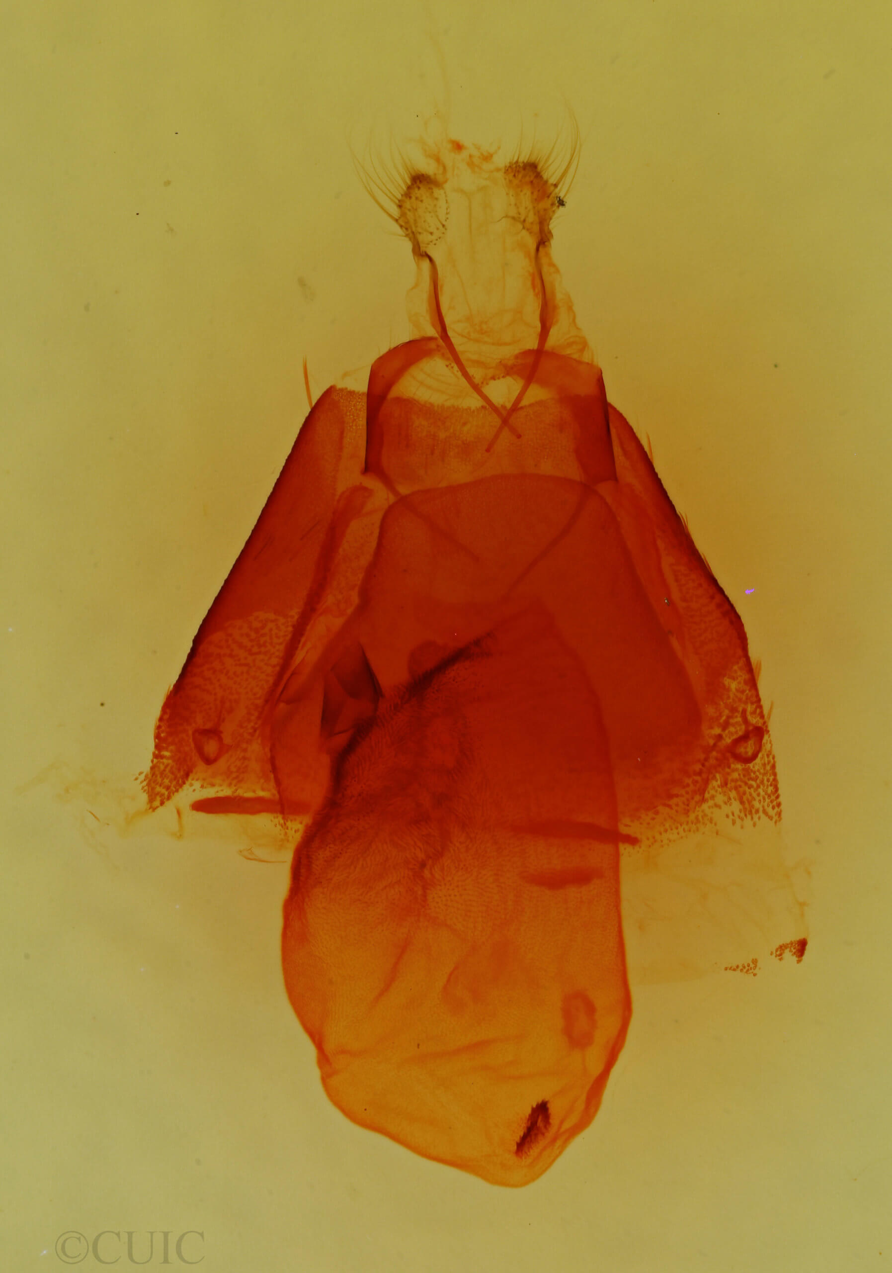 genitalia view of adult Matigramma emmilta