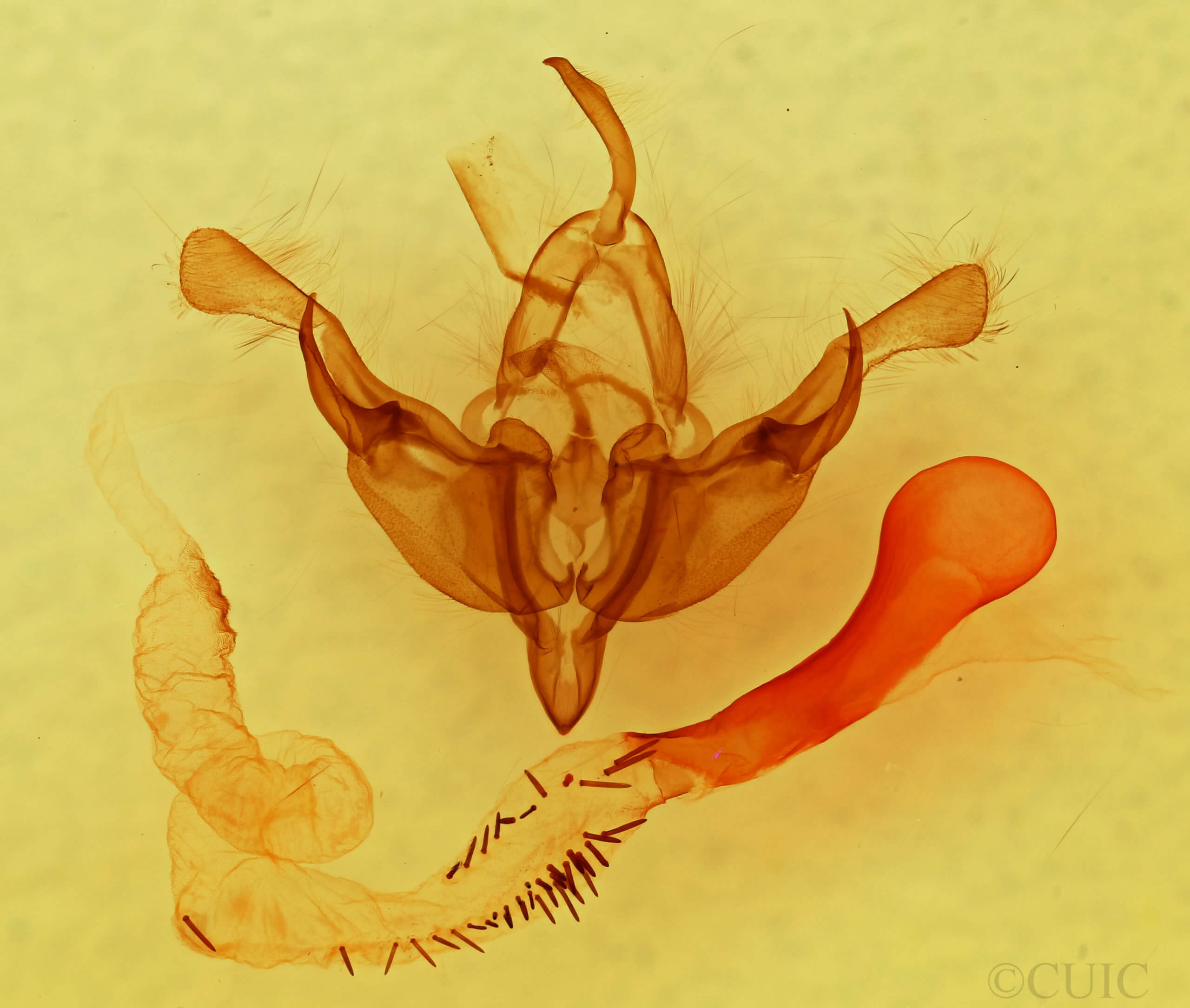 genitalia view of adult Anhypotrix tristis