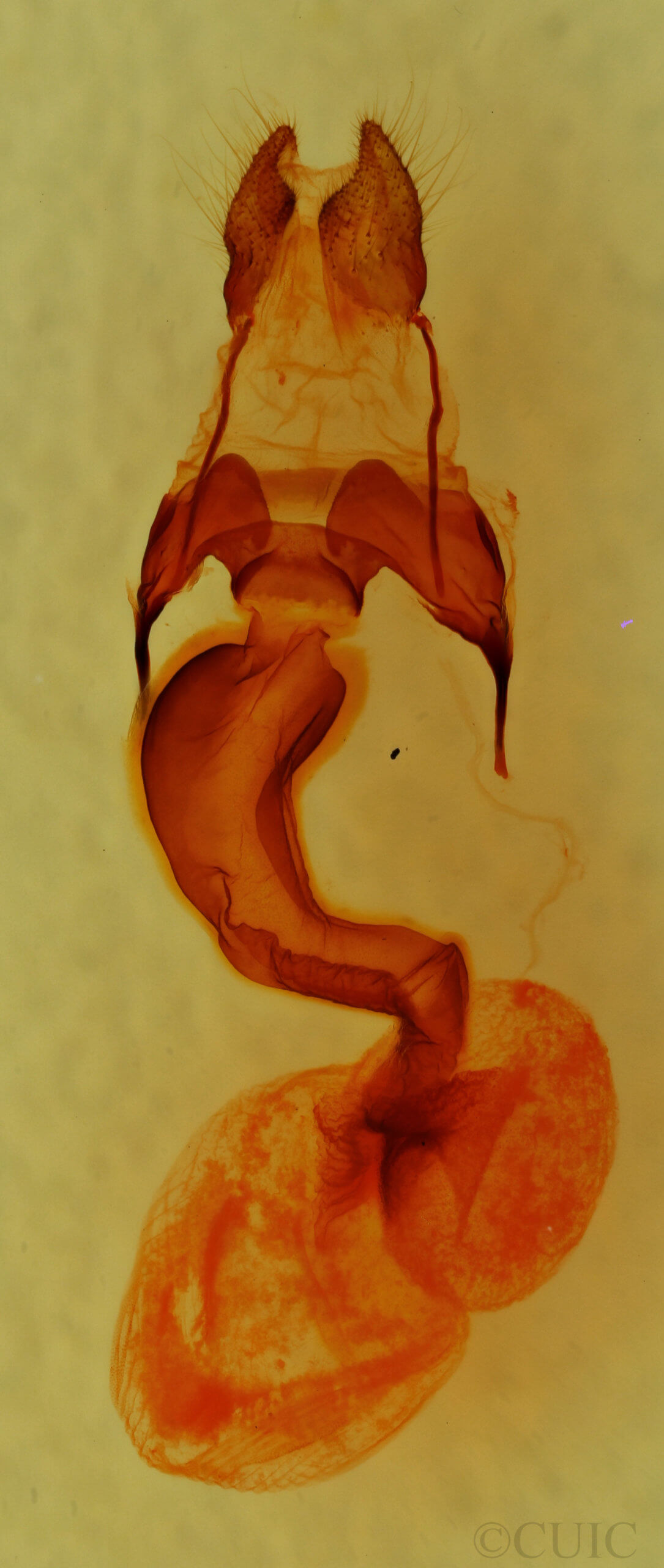 genitalia view of adult Anhypotrix tristis