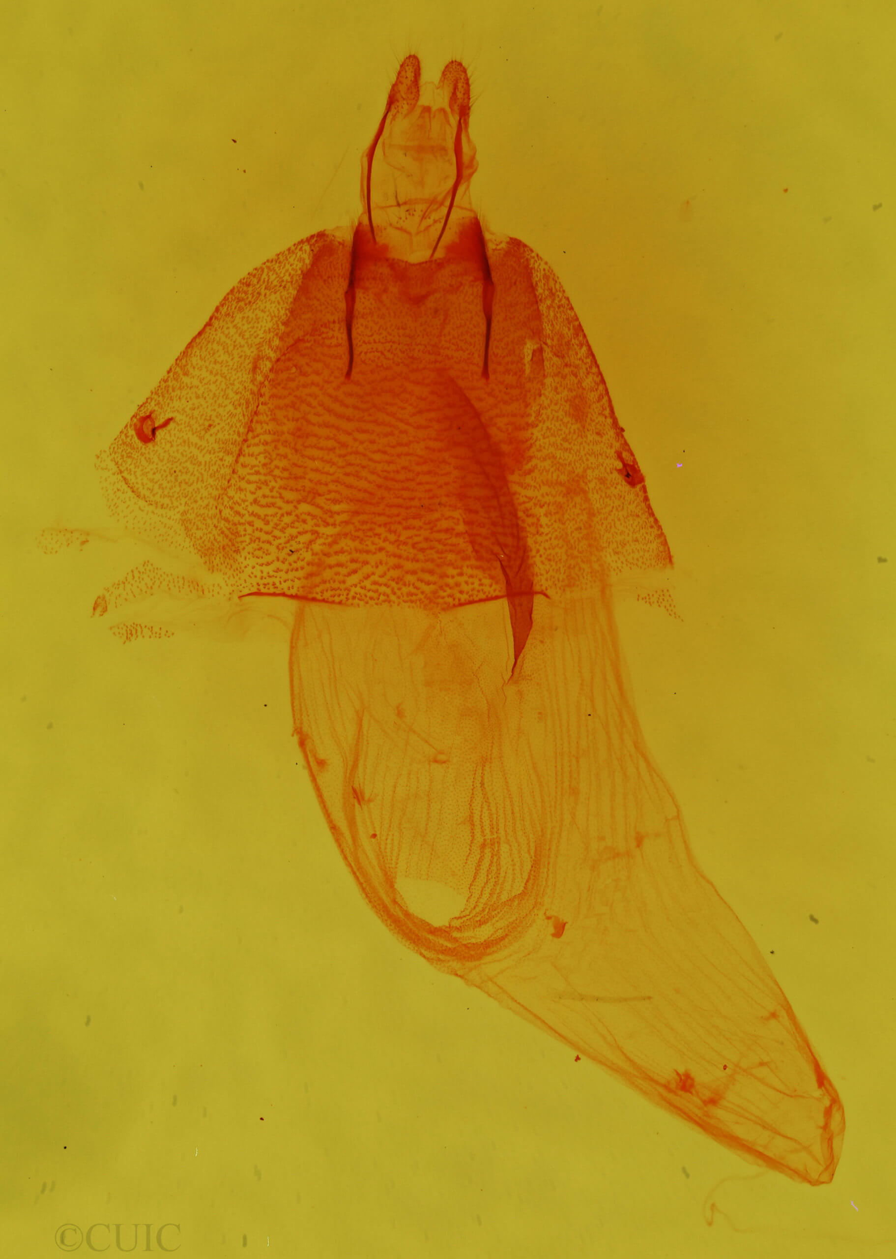 genitalia view of adult Nocloa aliaga