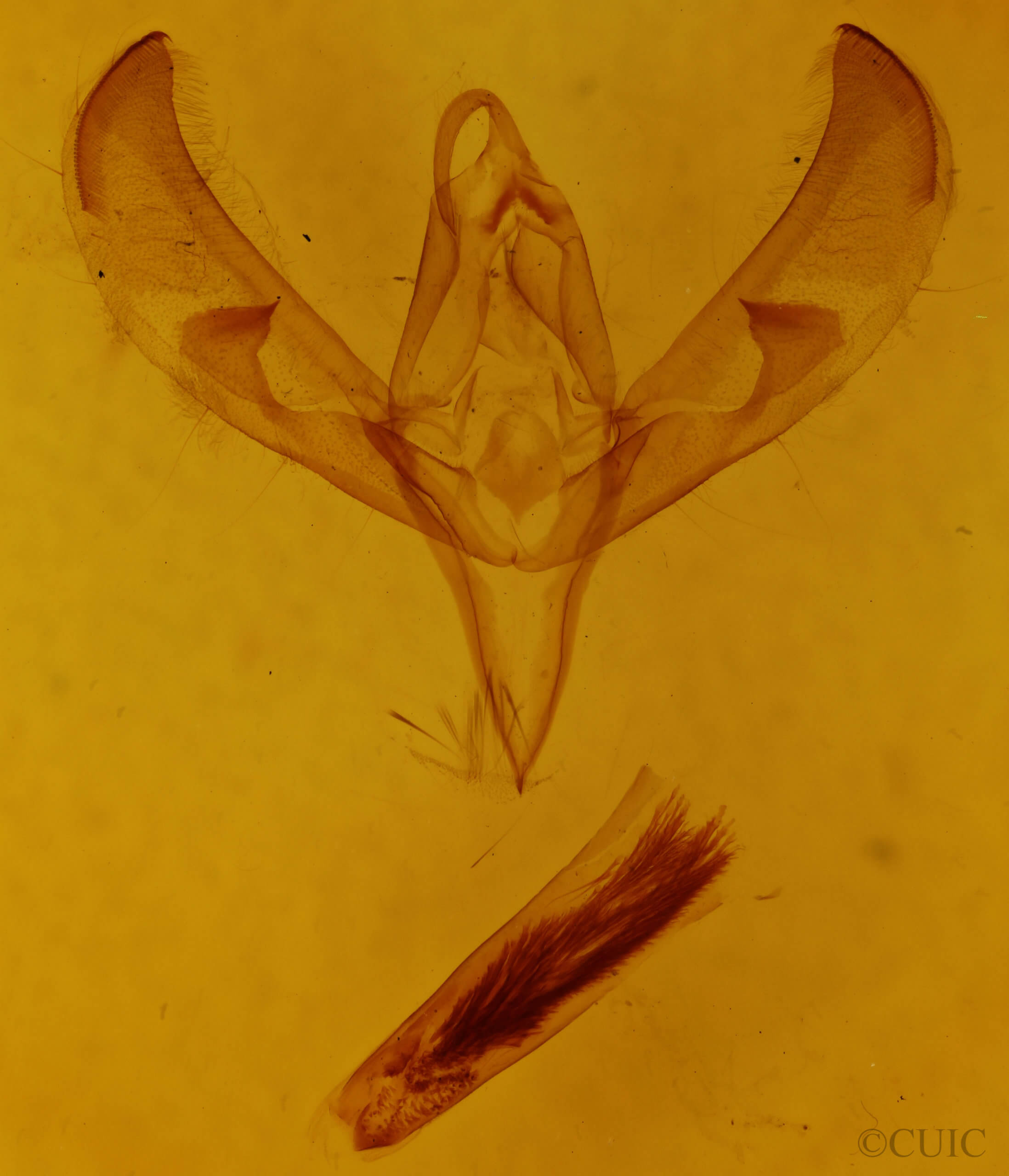 genitalia view of adult Sympistis