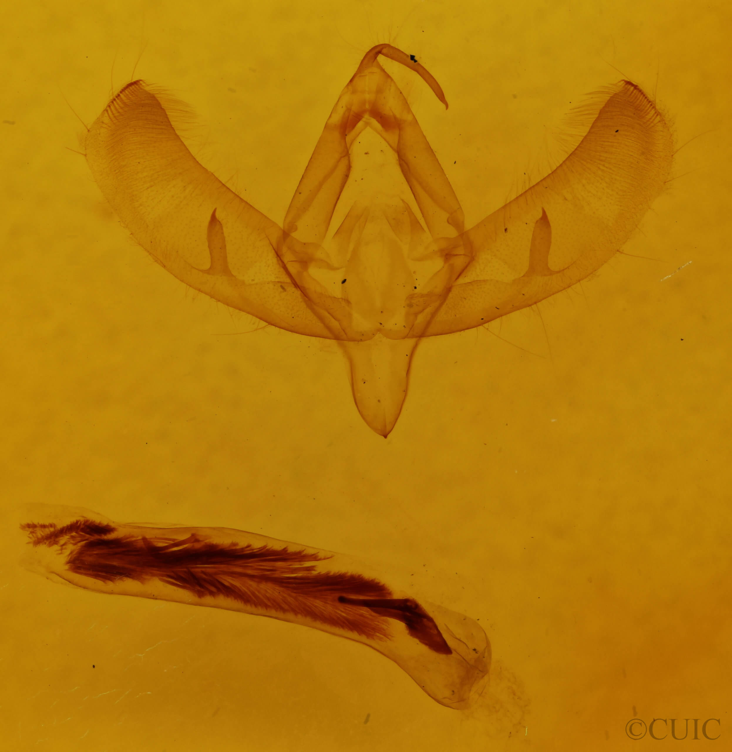 genitalia view of adult Sympistis