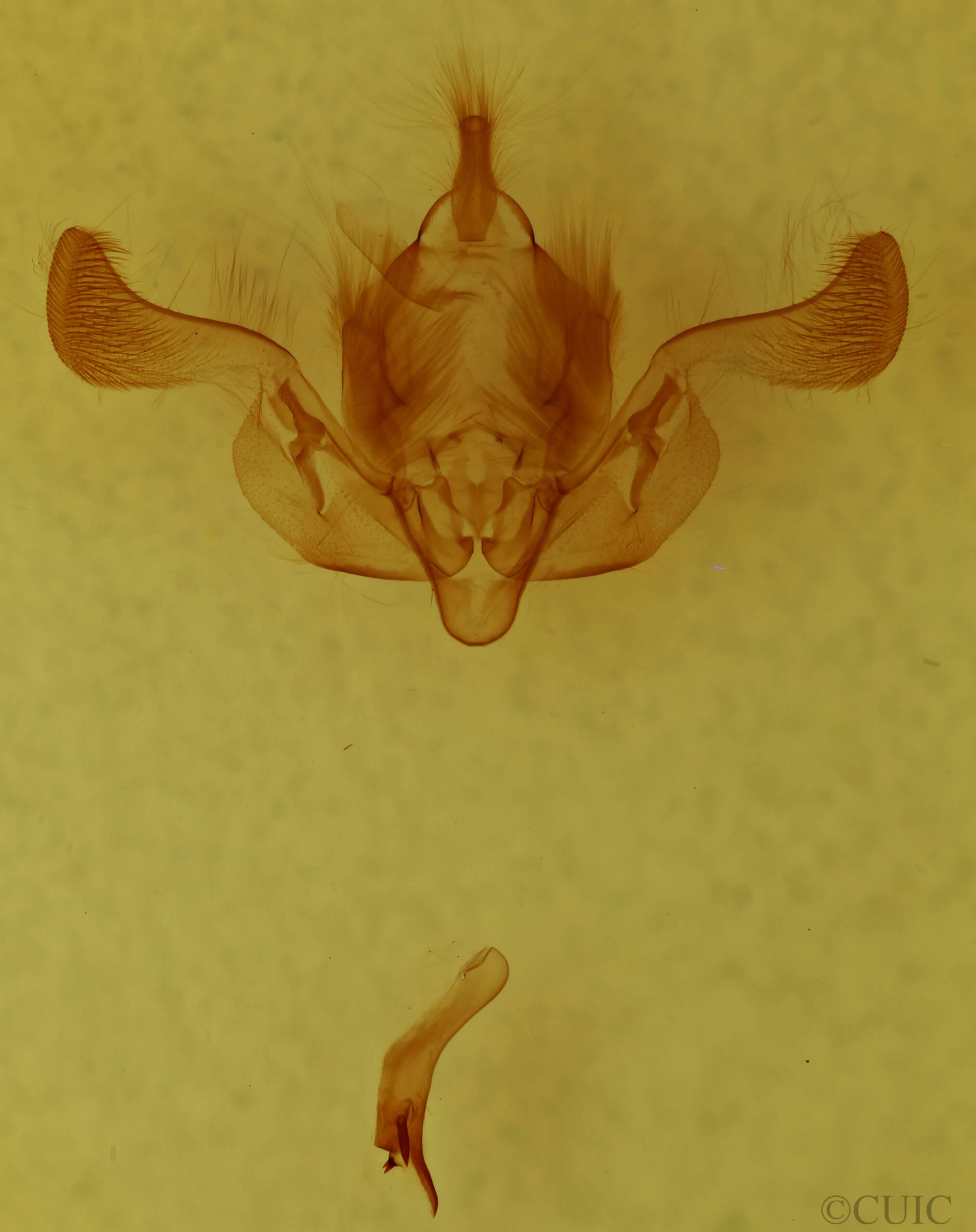 genitalia view of adult Properigea