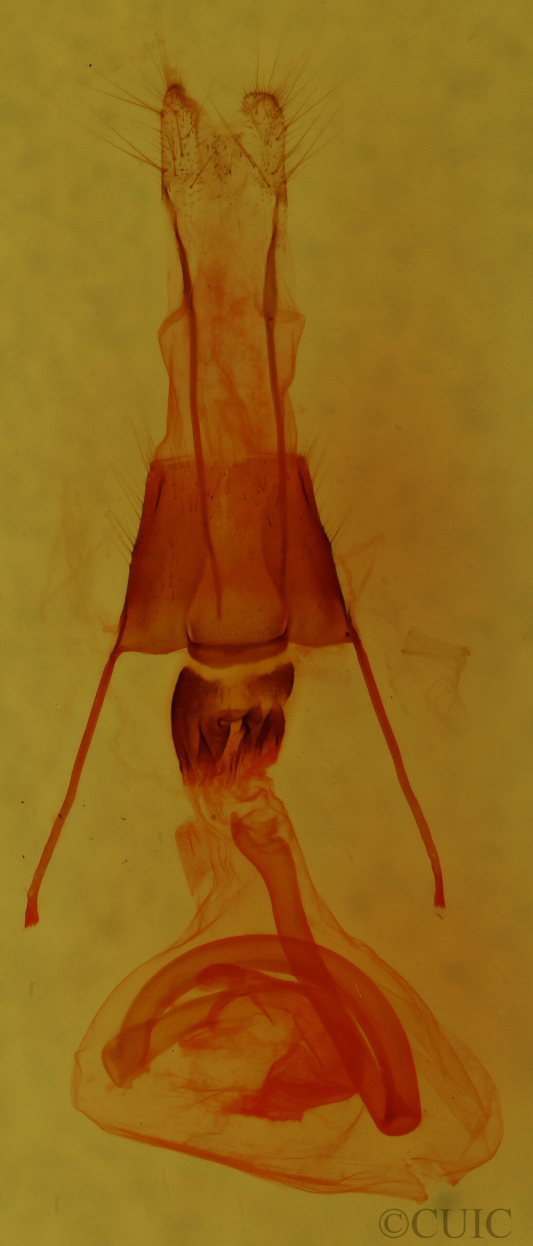 genitalia view of adult Properigea