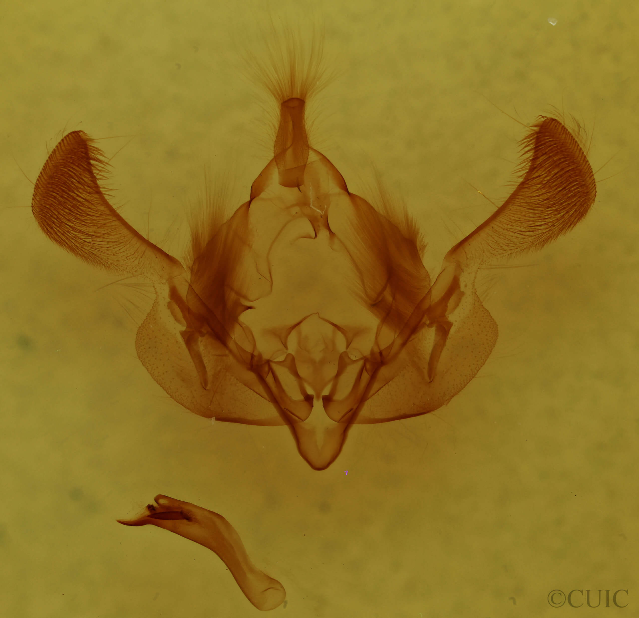 genitalia view of adult Properigea albimacula