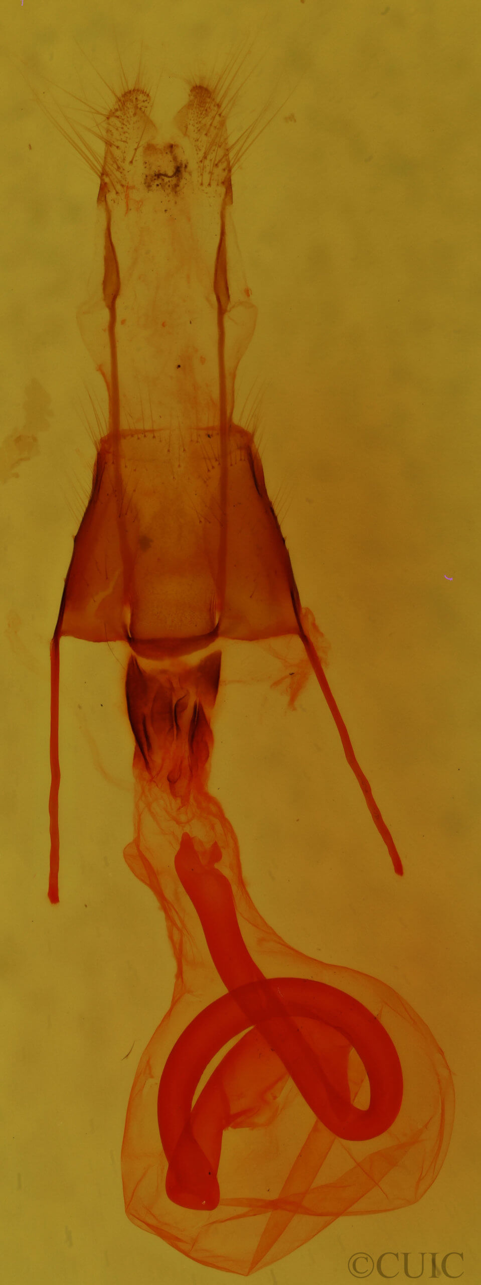 genitalia view of adult Properigea albimacula