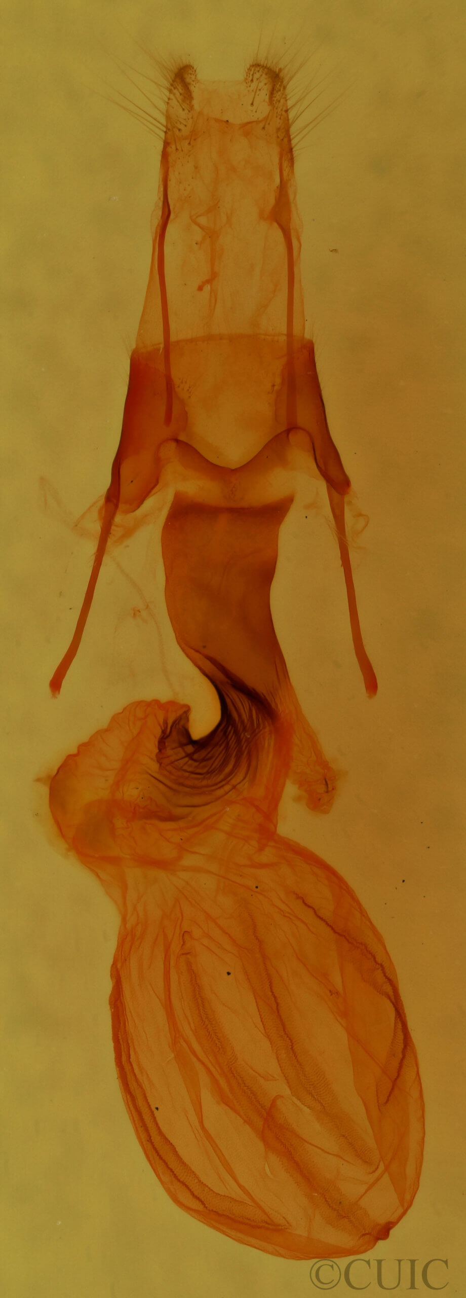 genitalia view of adult Pseudobryomima