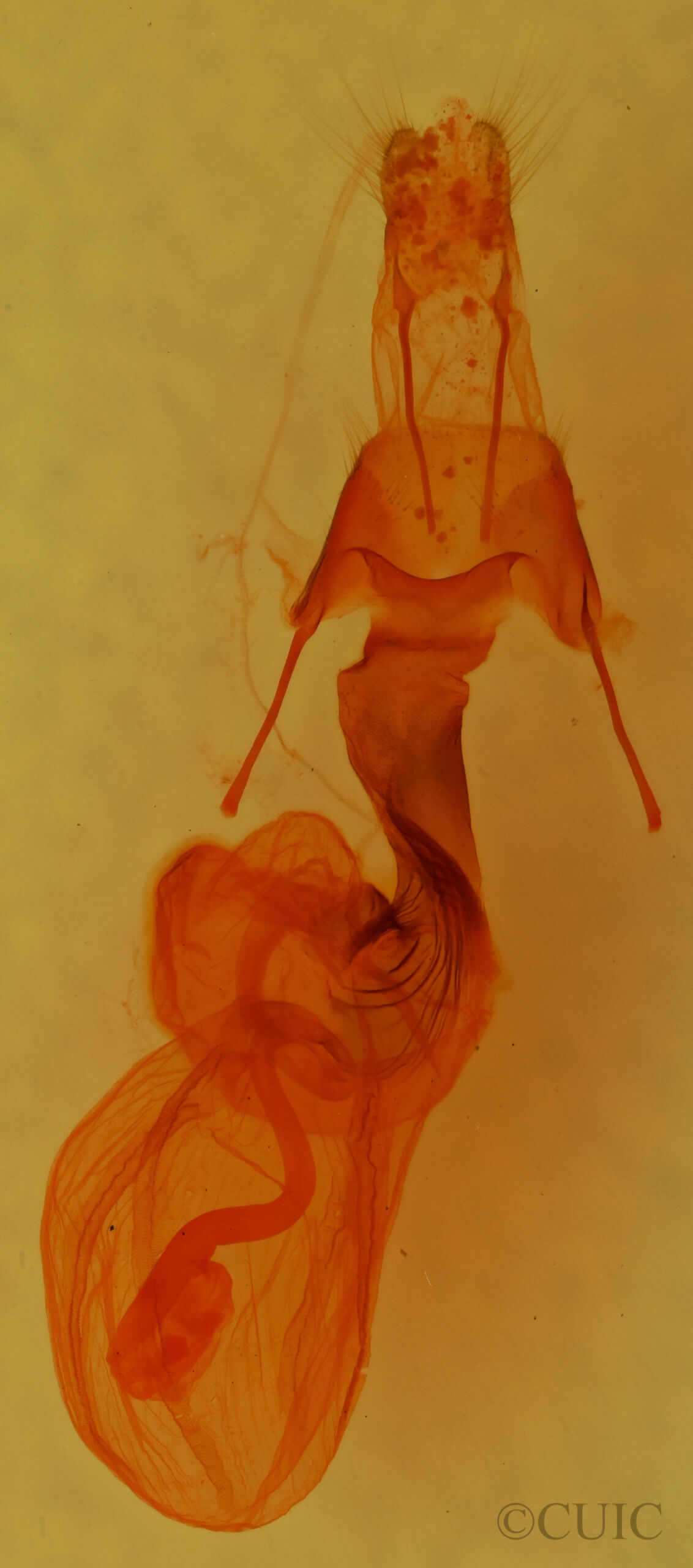 genitalia view of adult Pseudobryomima