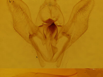 genitalia view of adult Psilosetia