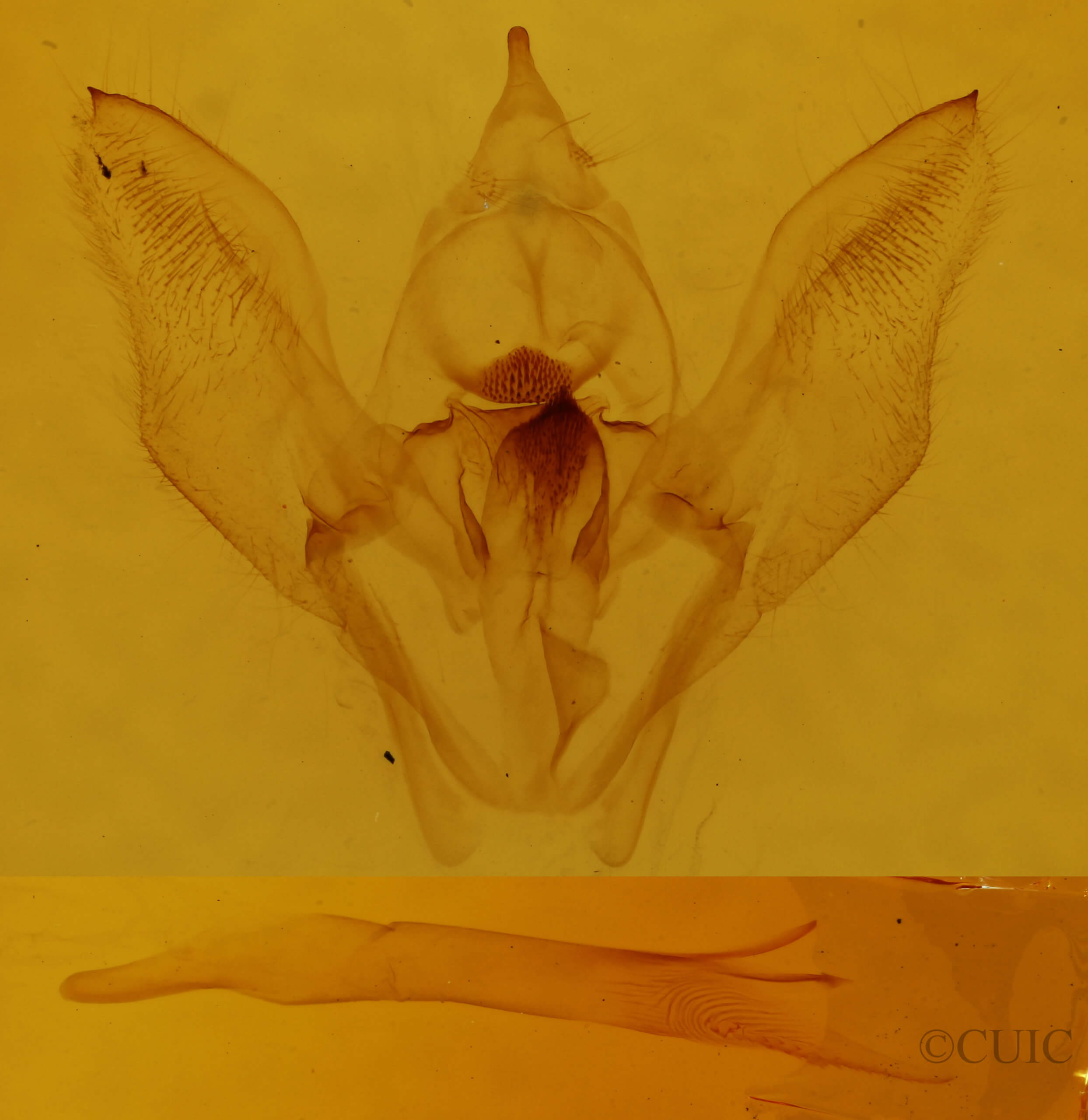 genitalia view of adult Psilosetia