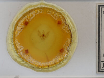 slide view of adult Psilosetia