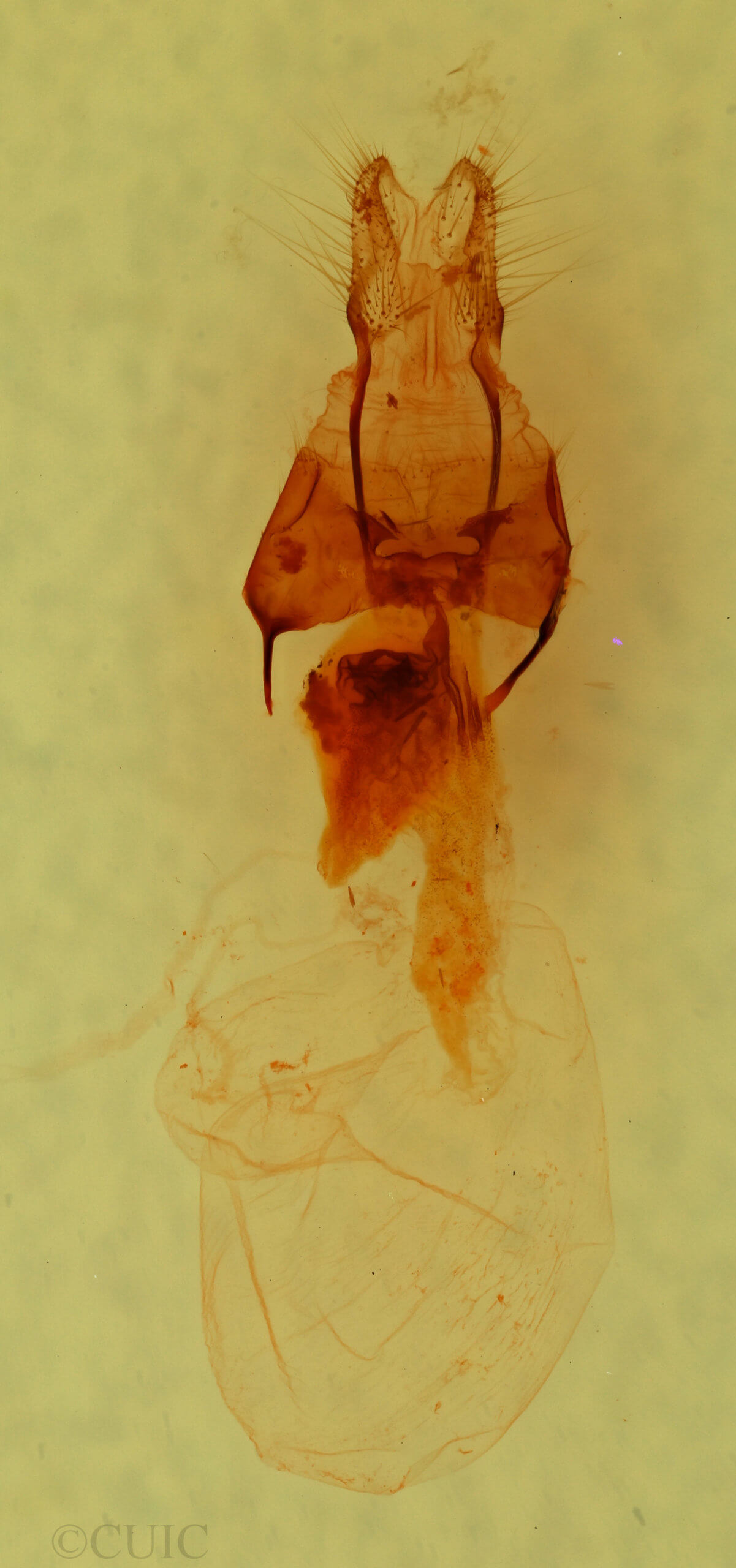 genitalia view of adult Trichofeltia circumdata