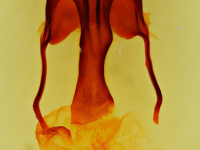 genitalia view of adult Tricholita signata