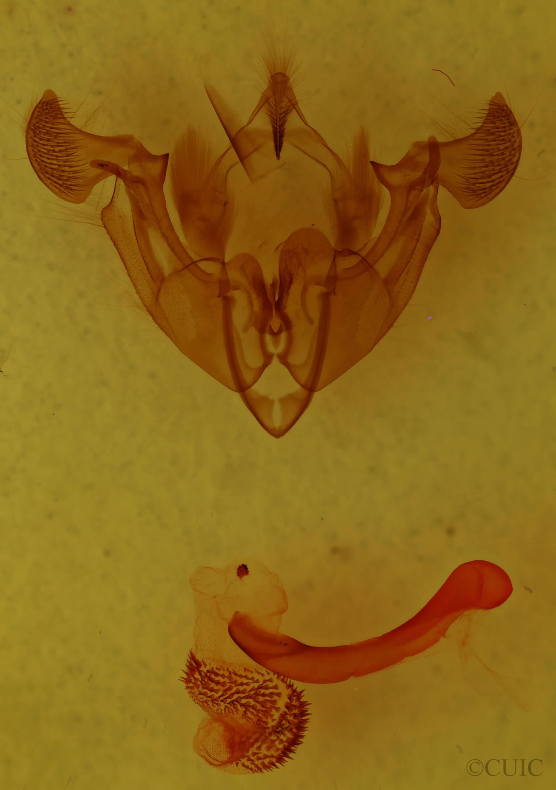 genitalia view of adult Trichordestra lilacina