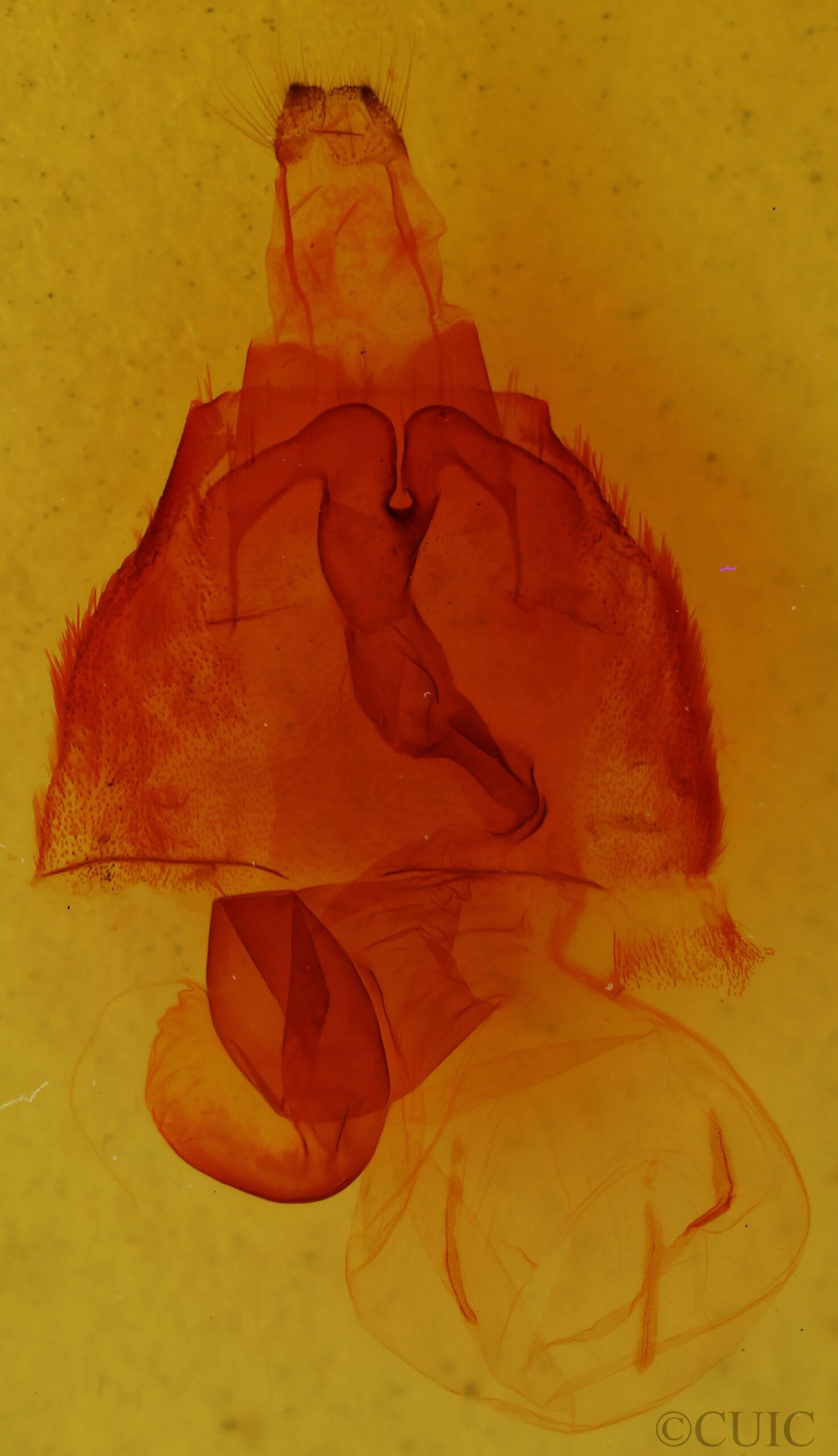 genitalia view of adult Trichordestra lilacina