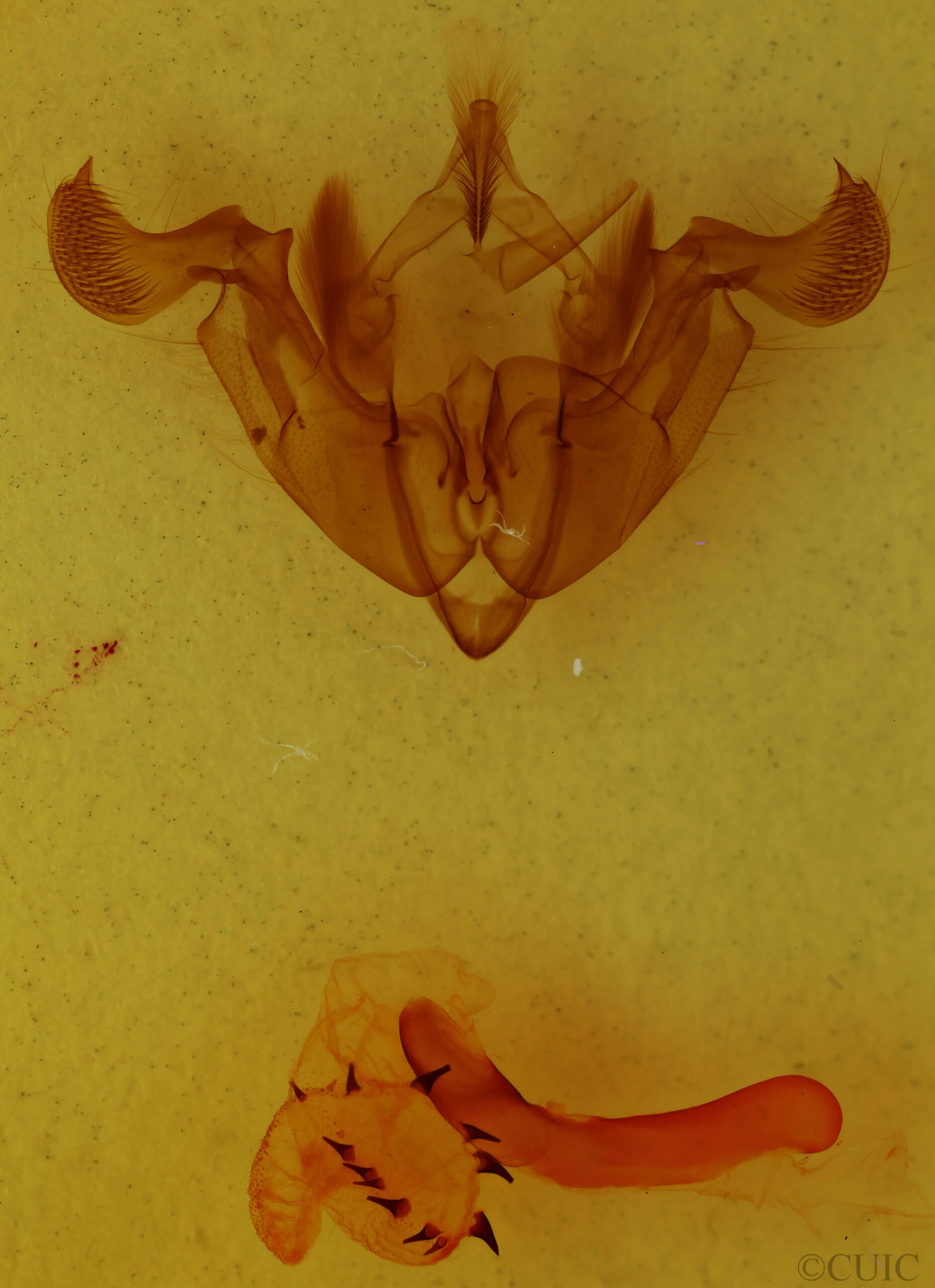 genitalia view of adult Trichordestra prodeniformis