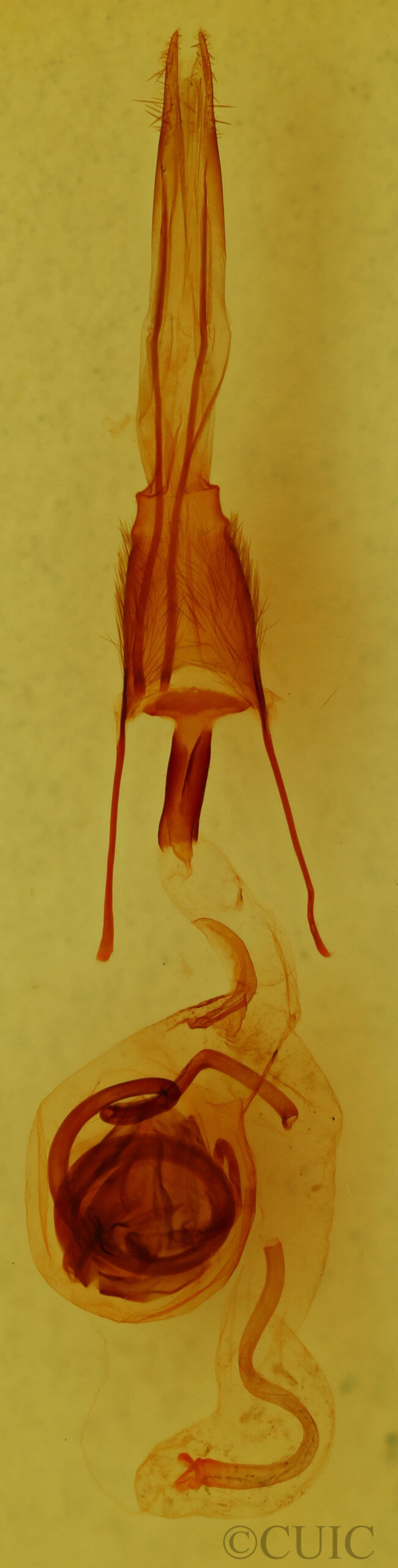 genitalia view of adult Ulolonche modesta