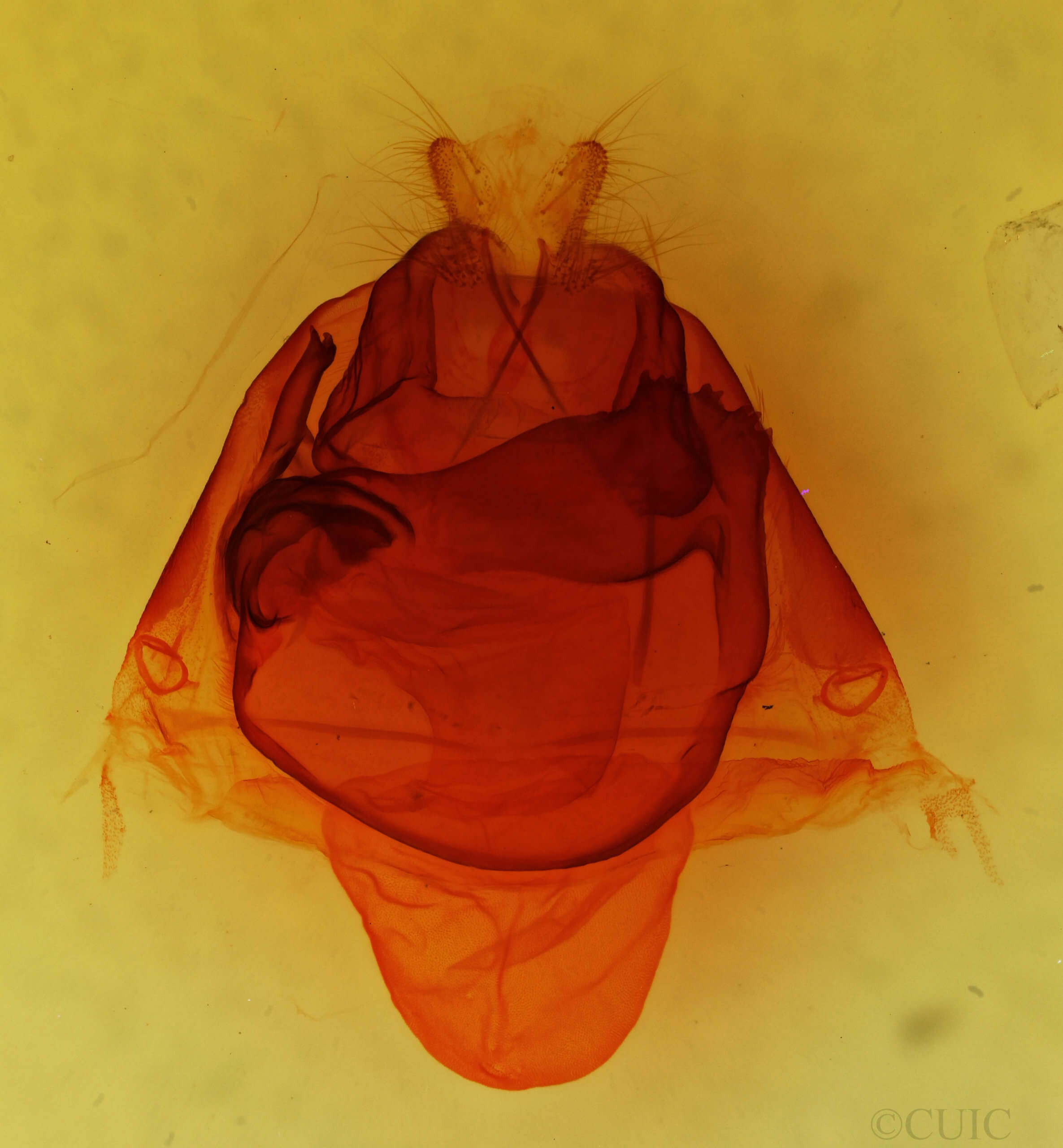 genitalia view of adult Zale lunata