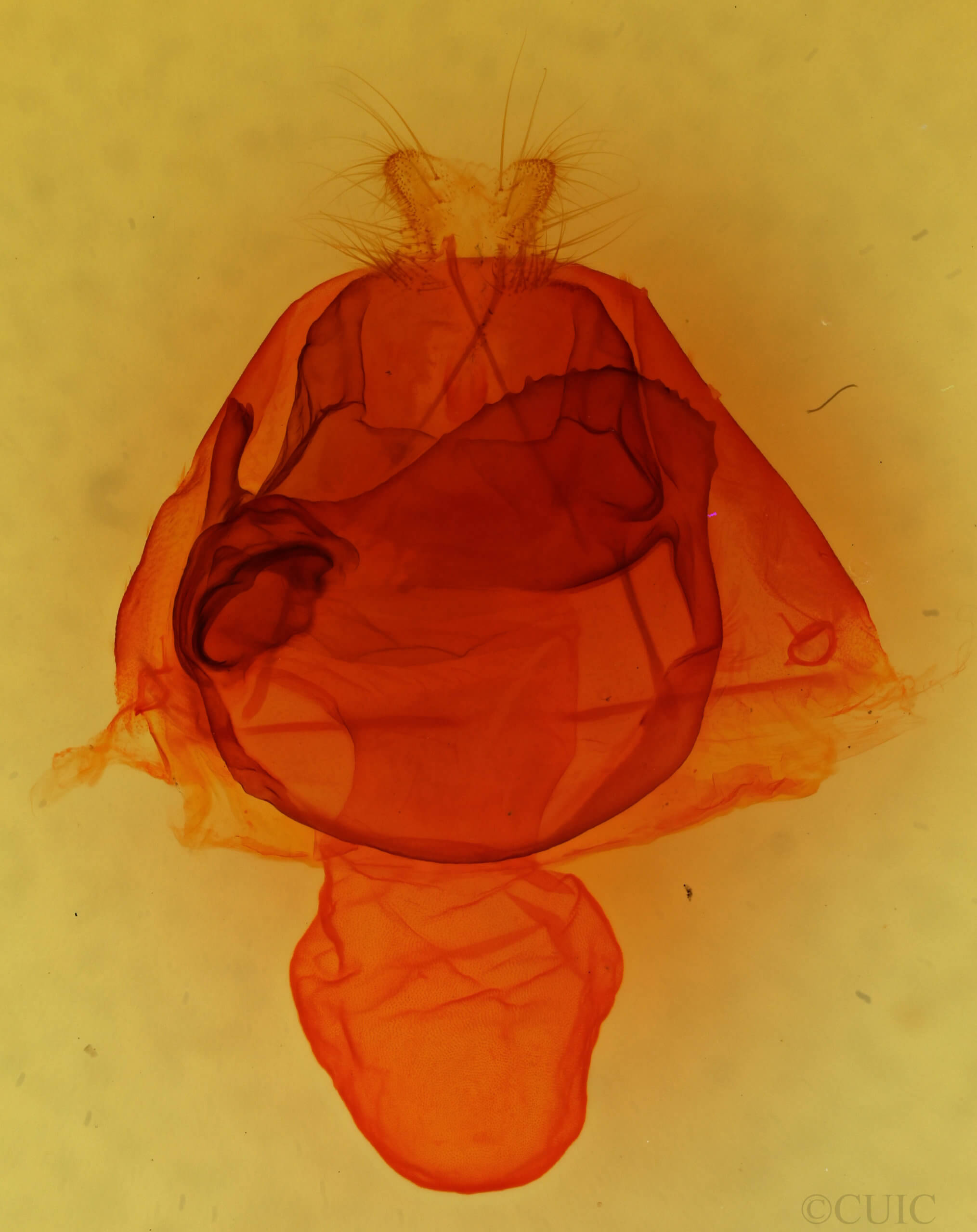 genitalia view of adult Zale lunata