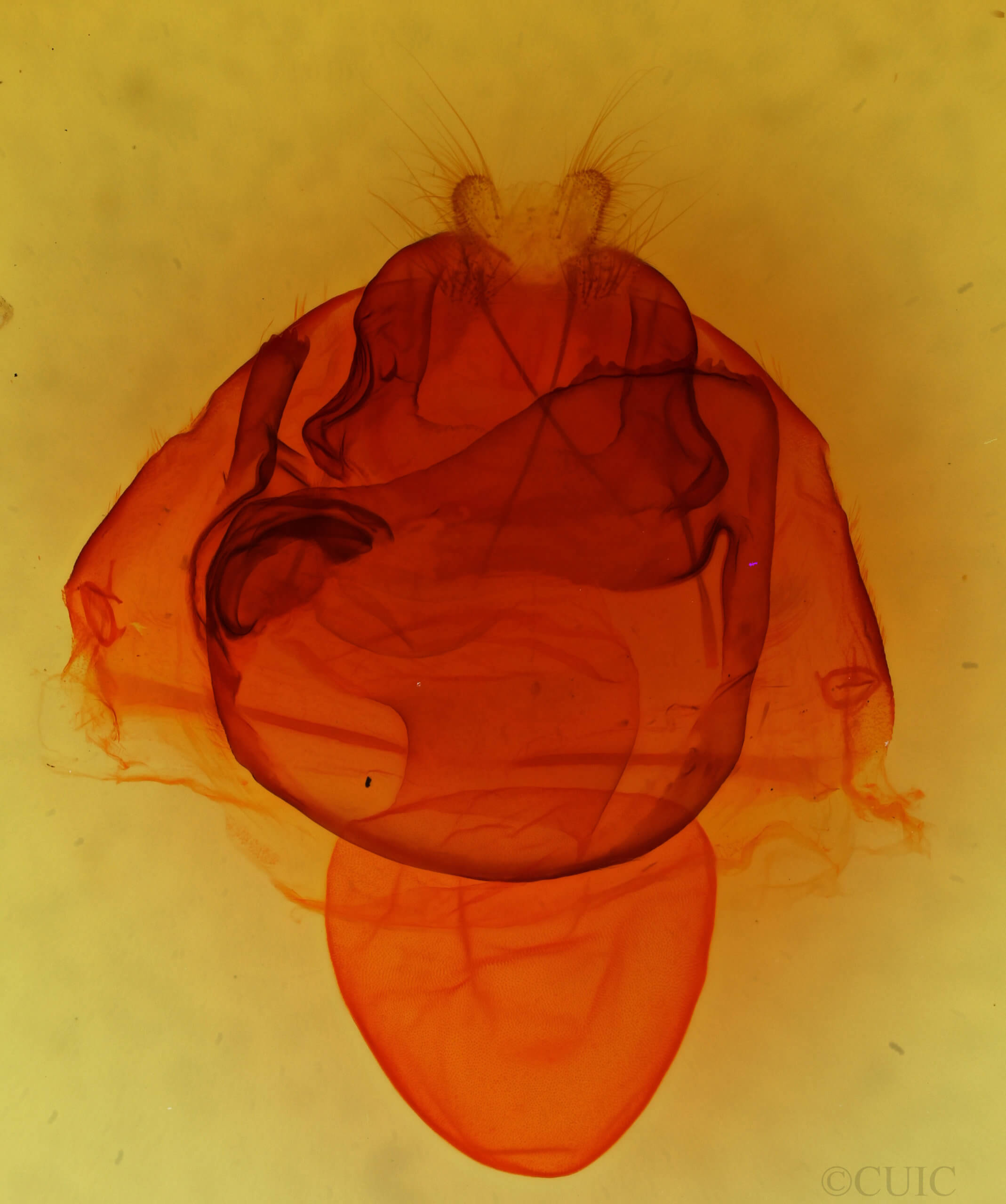 genitalia view of adult Zale lunata