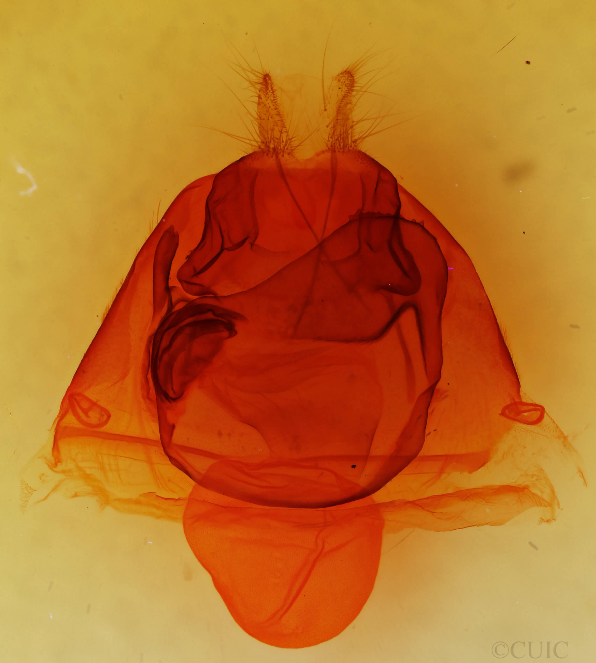 genitalia view of adult Zale lunata