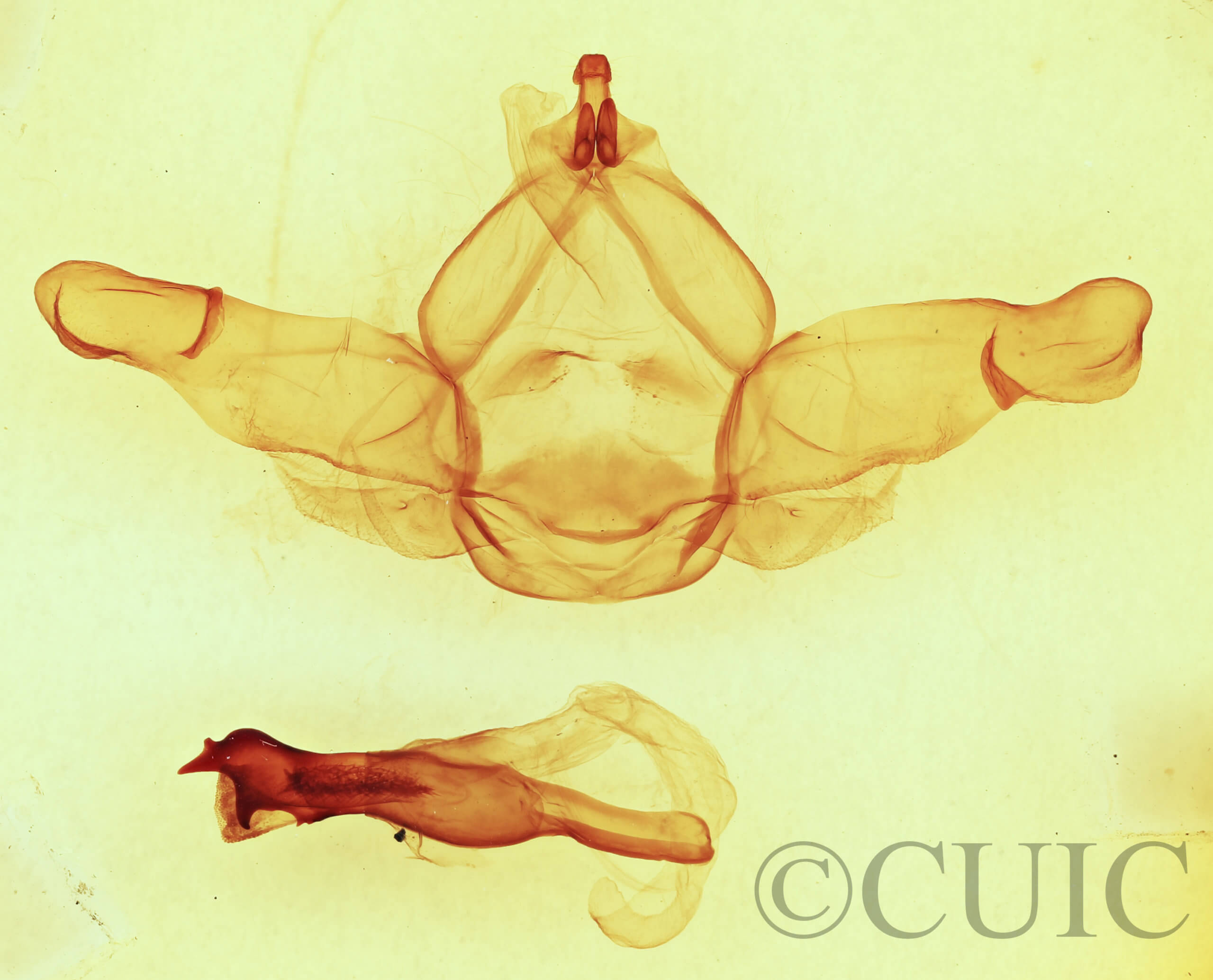 genitalia view of adult Nadata gibbosa