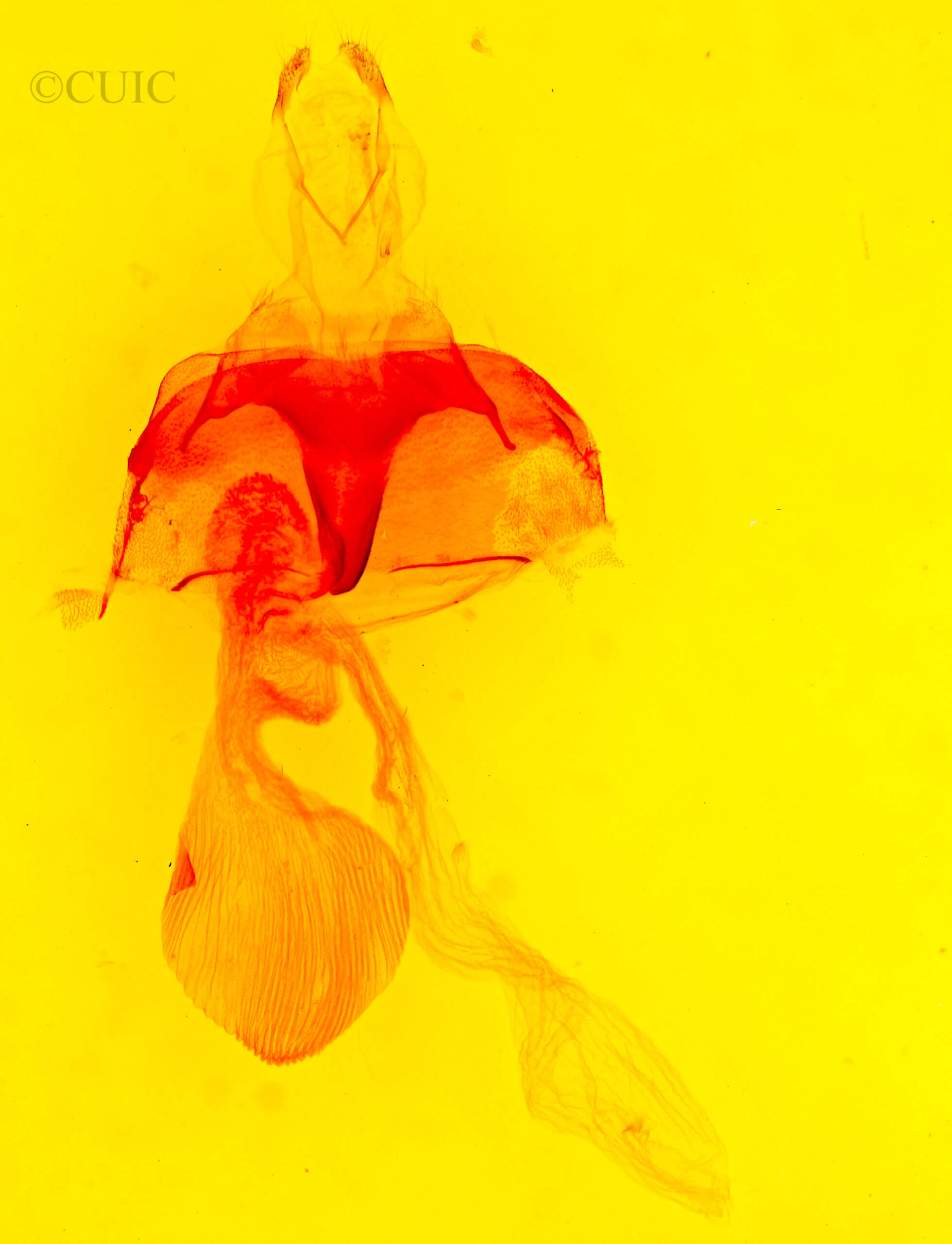 genitalia view of adult Abagrotis  scopeops