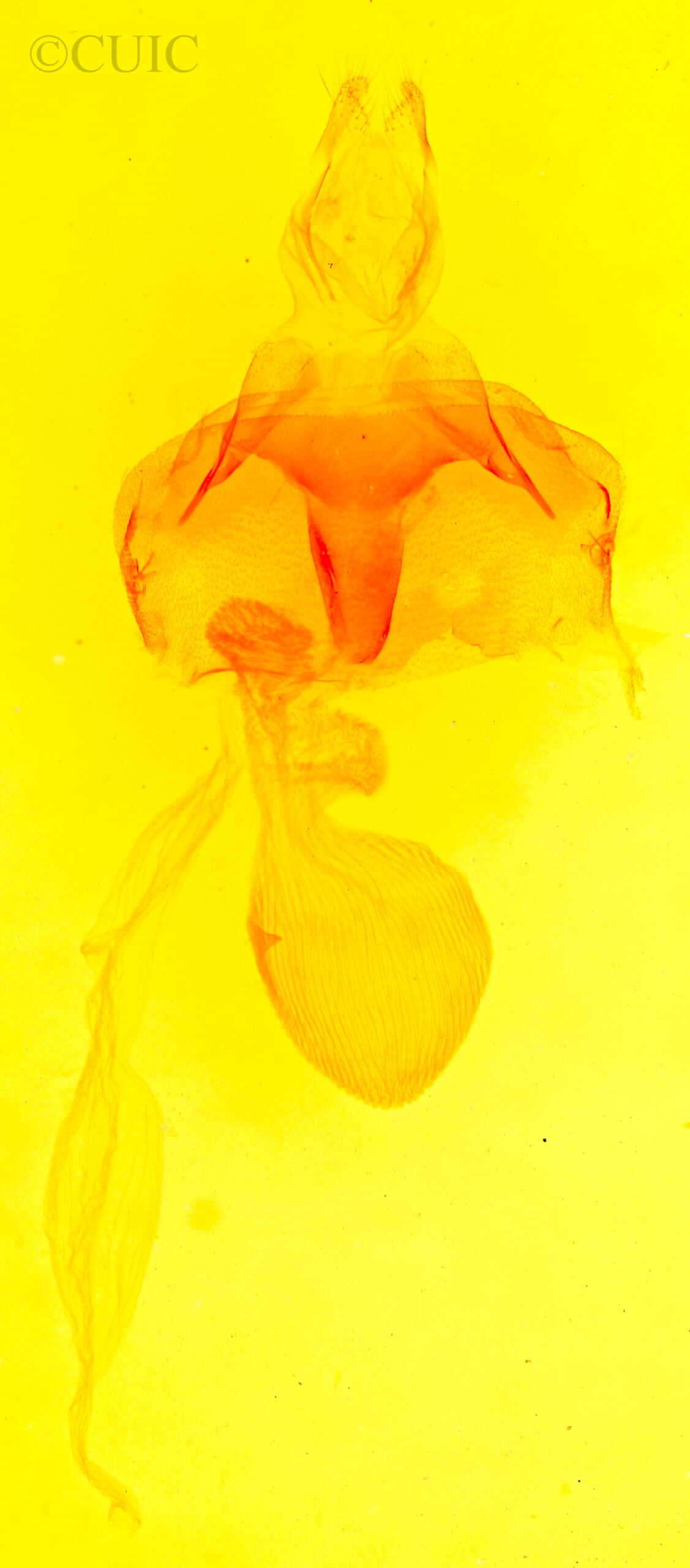 genitalia view of adult Abagrotis scopeops