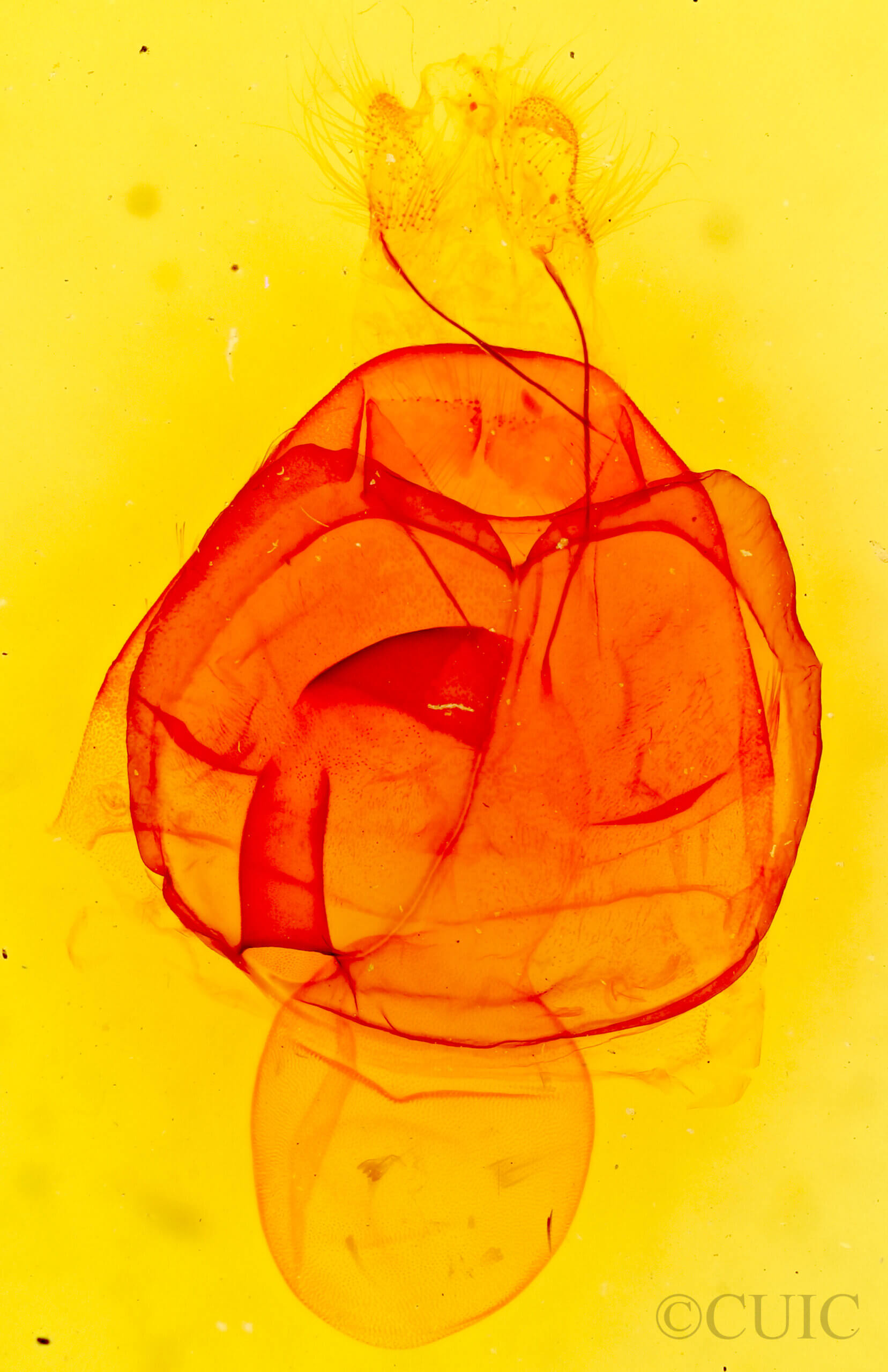 genitalia view of adult Zale squamularis
