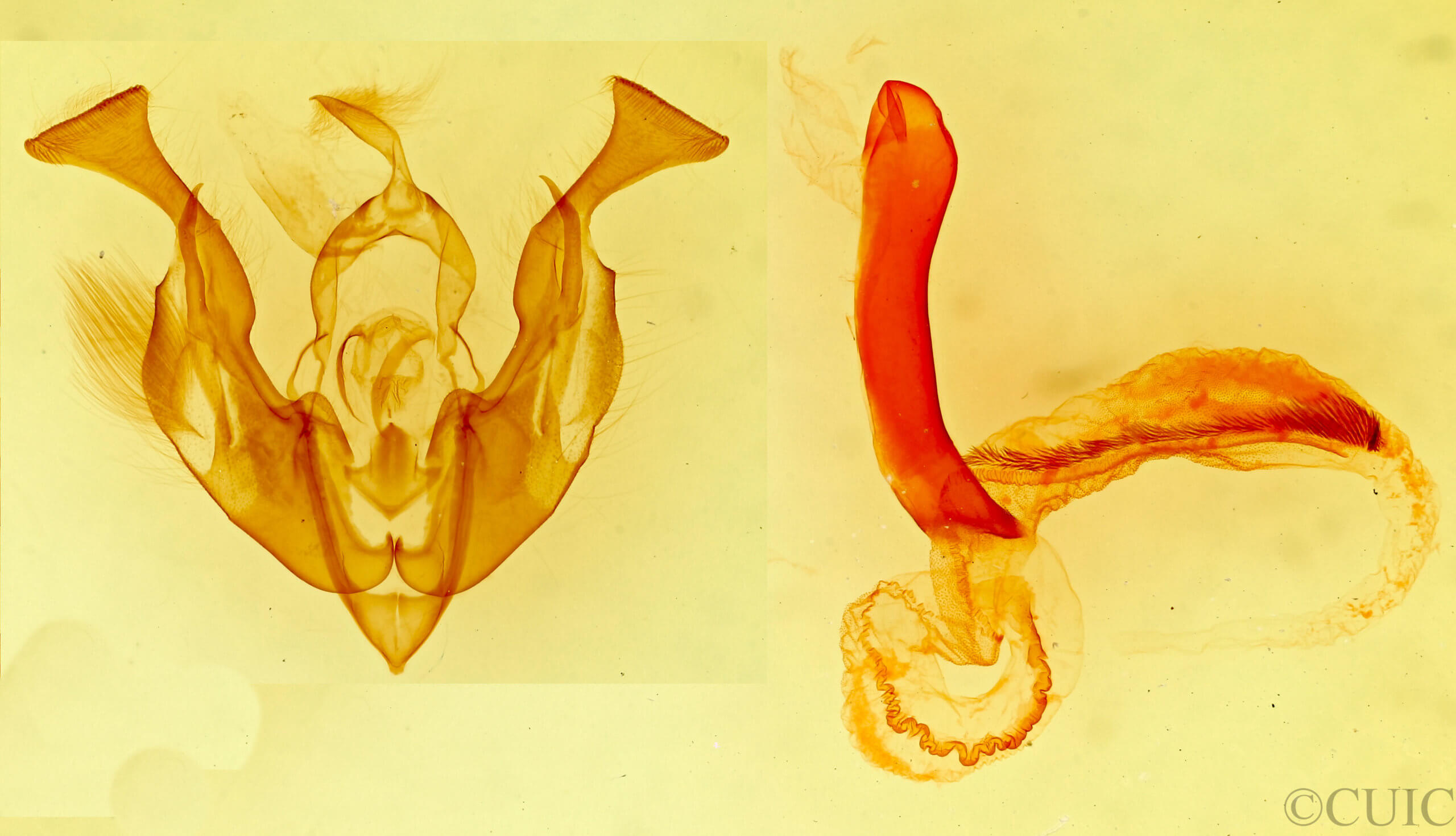 genitalia view of adult Lacinipolia aileenae