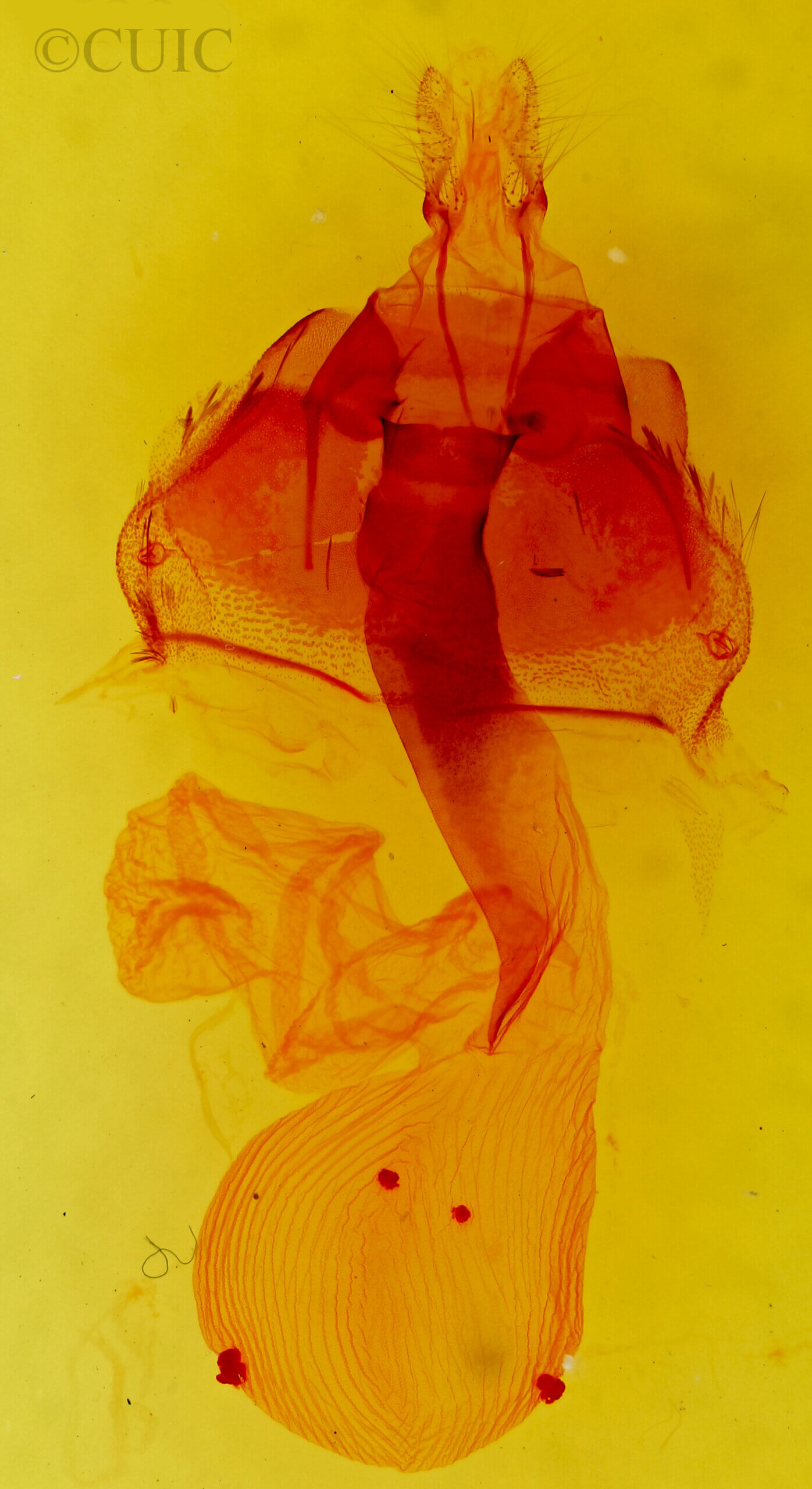 genitalia view of adult Lacinipolia aileenae