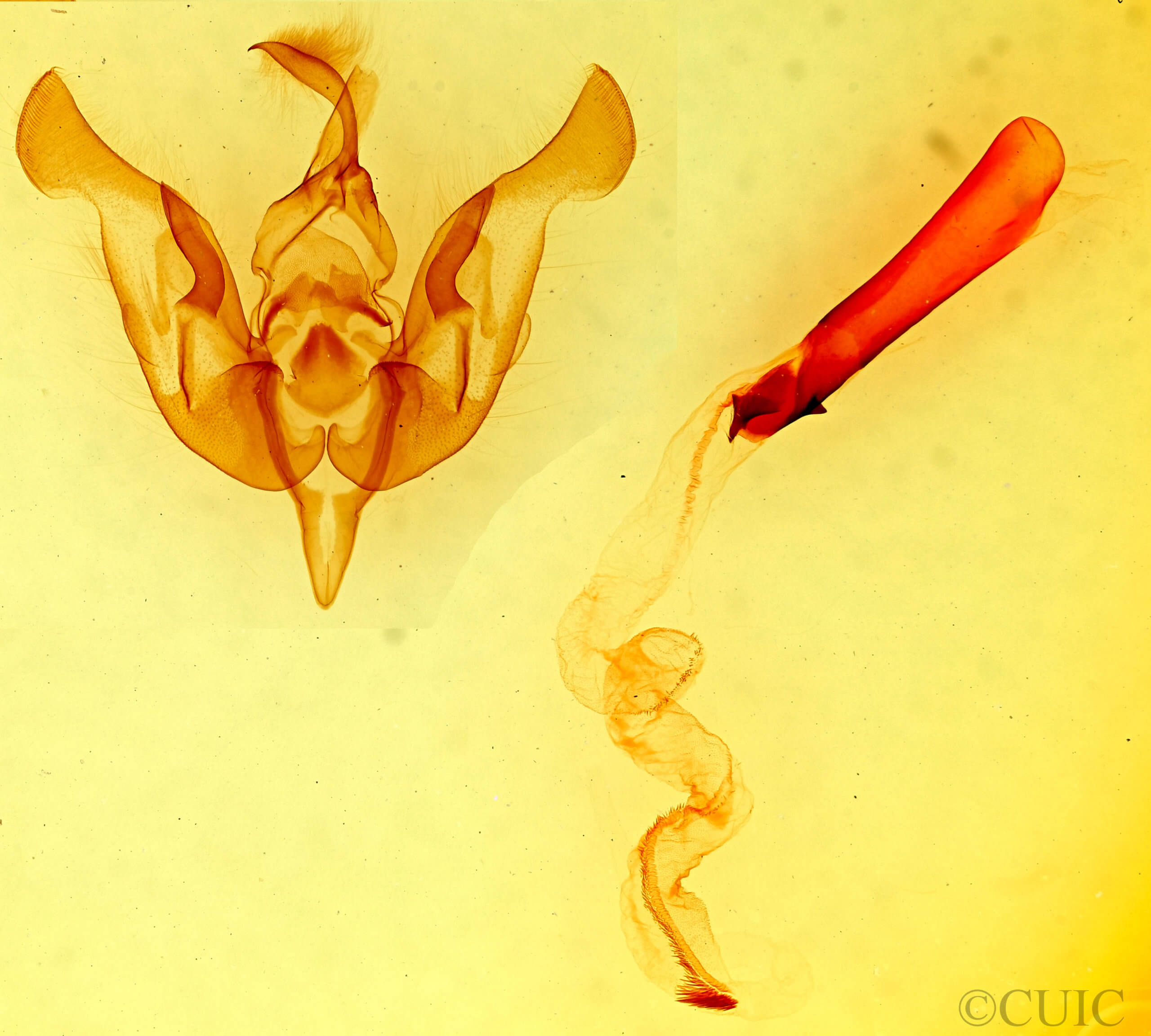 genitalia view of adult Lacinipolia gnata