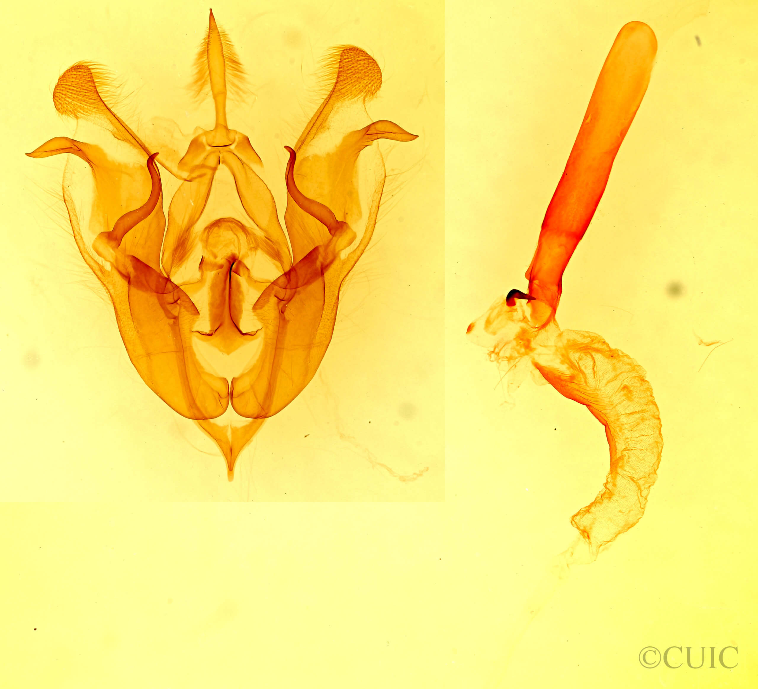 genitalia view of adult Protorthodes incincta