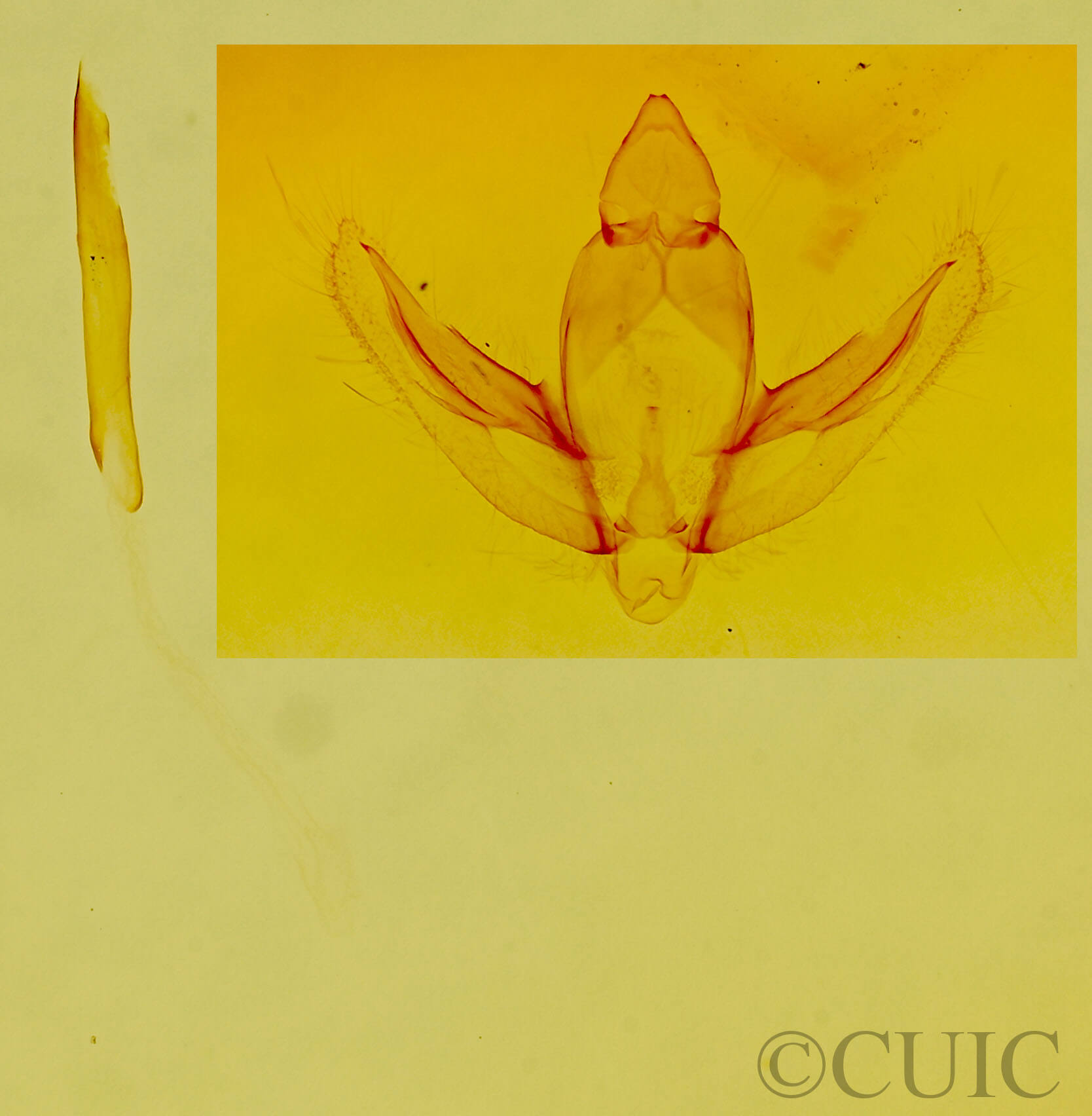 genitalia view of adult Stenoporpia vernata