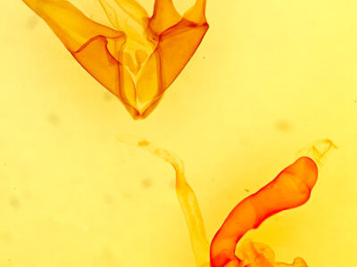 genitalia view of adult Matigramma emmilta