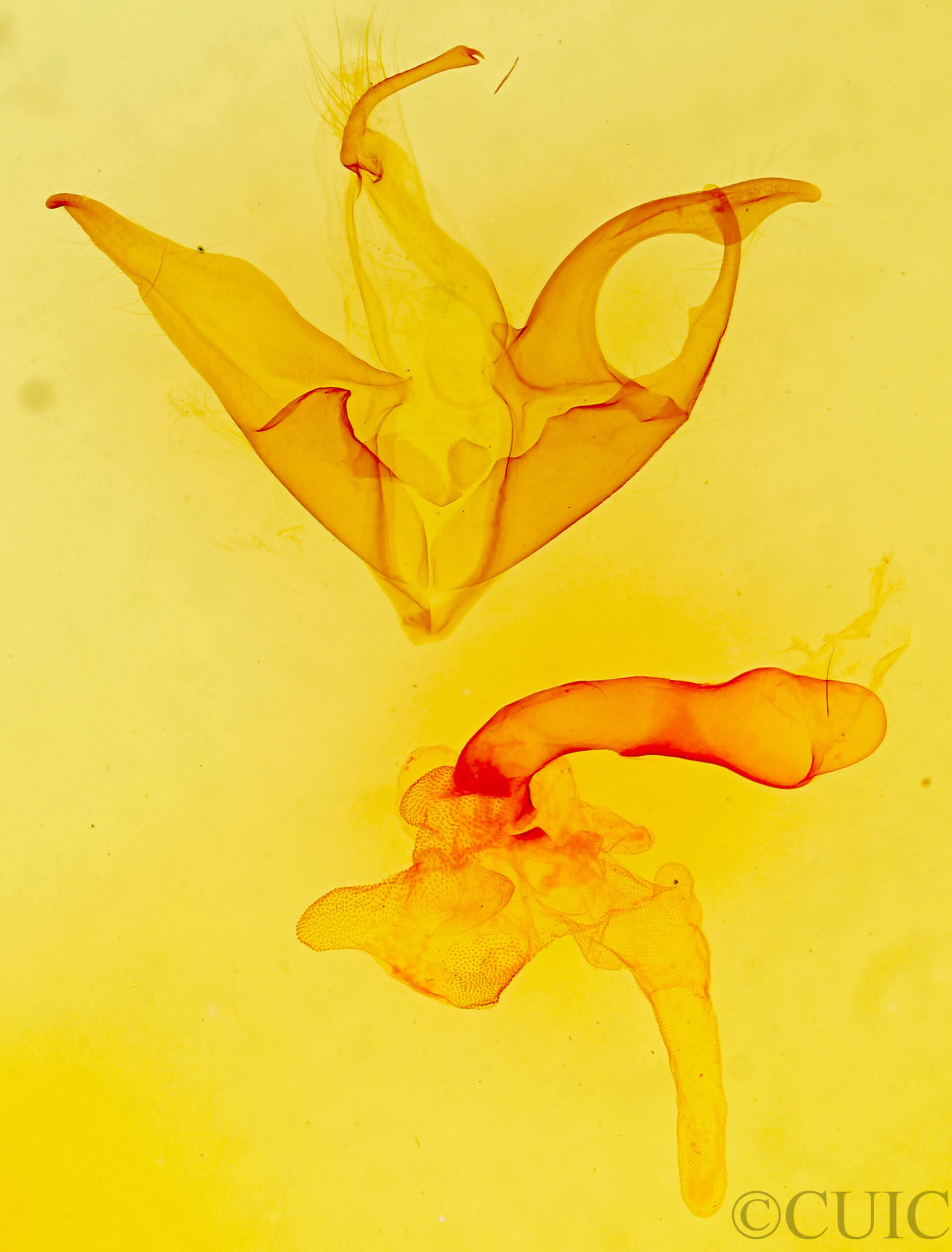 genitalia view of adult Matigramma emmilta