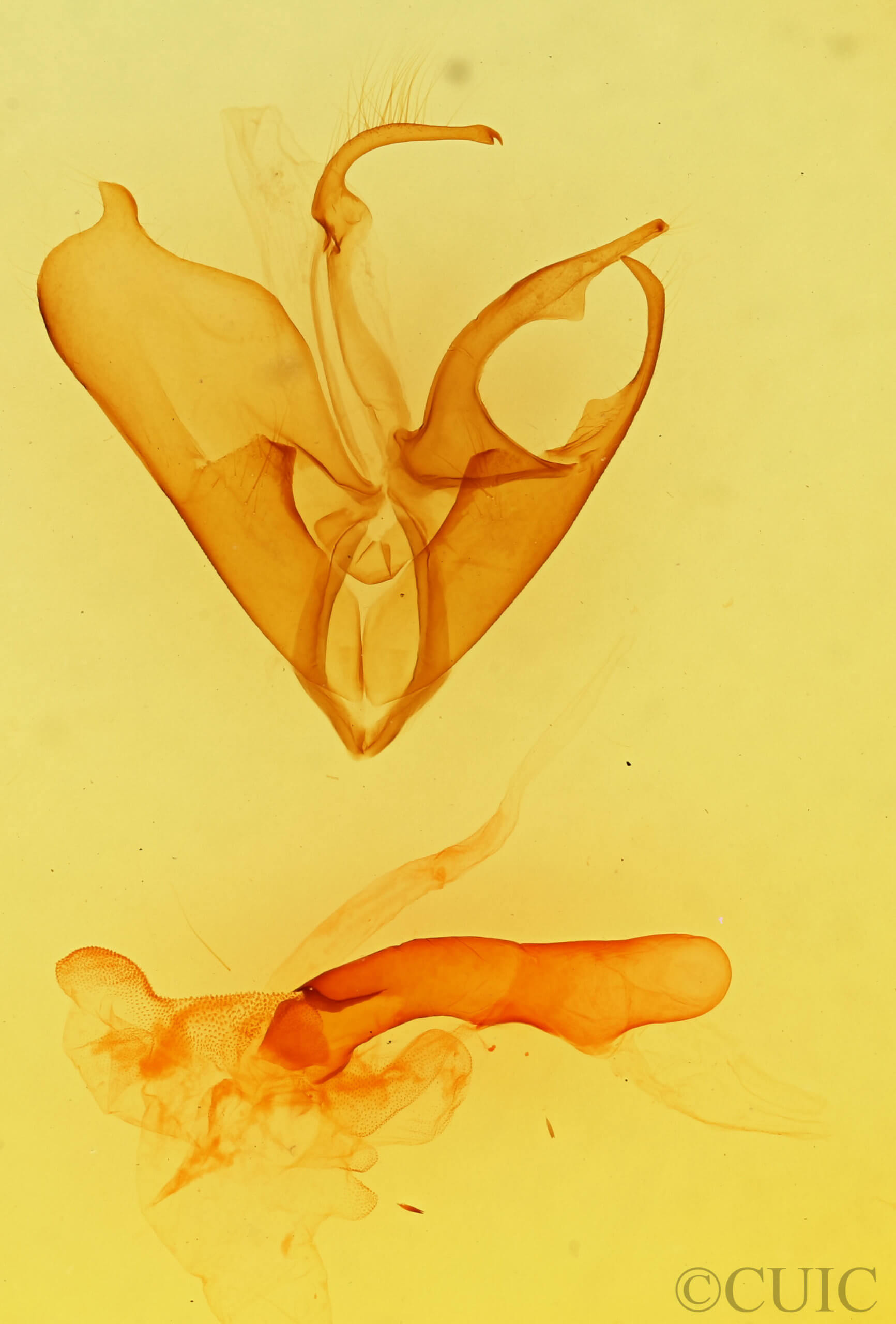 genitalia view of adult Matigramma repentina