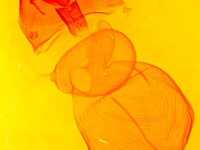 genitalia view of adult Xestia c-nigrum