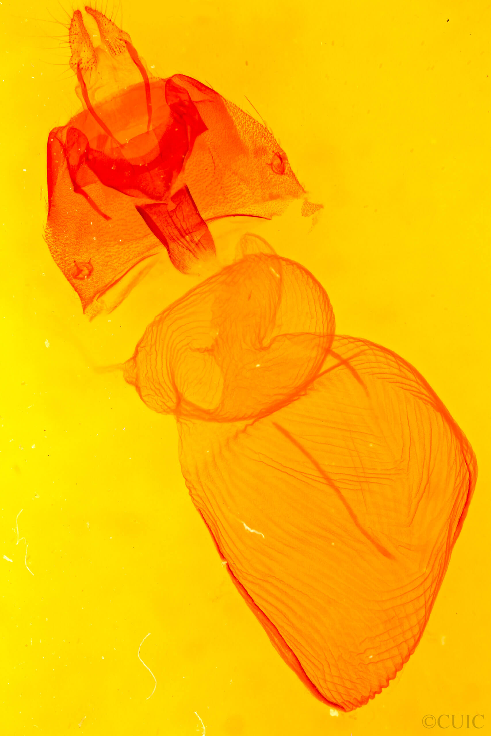 genitalia view of adult Xestia c-nigrum