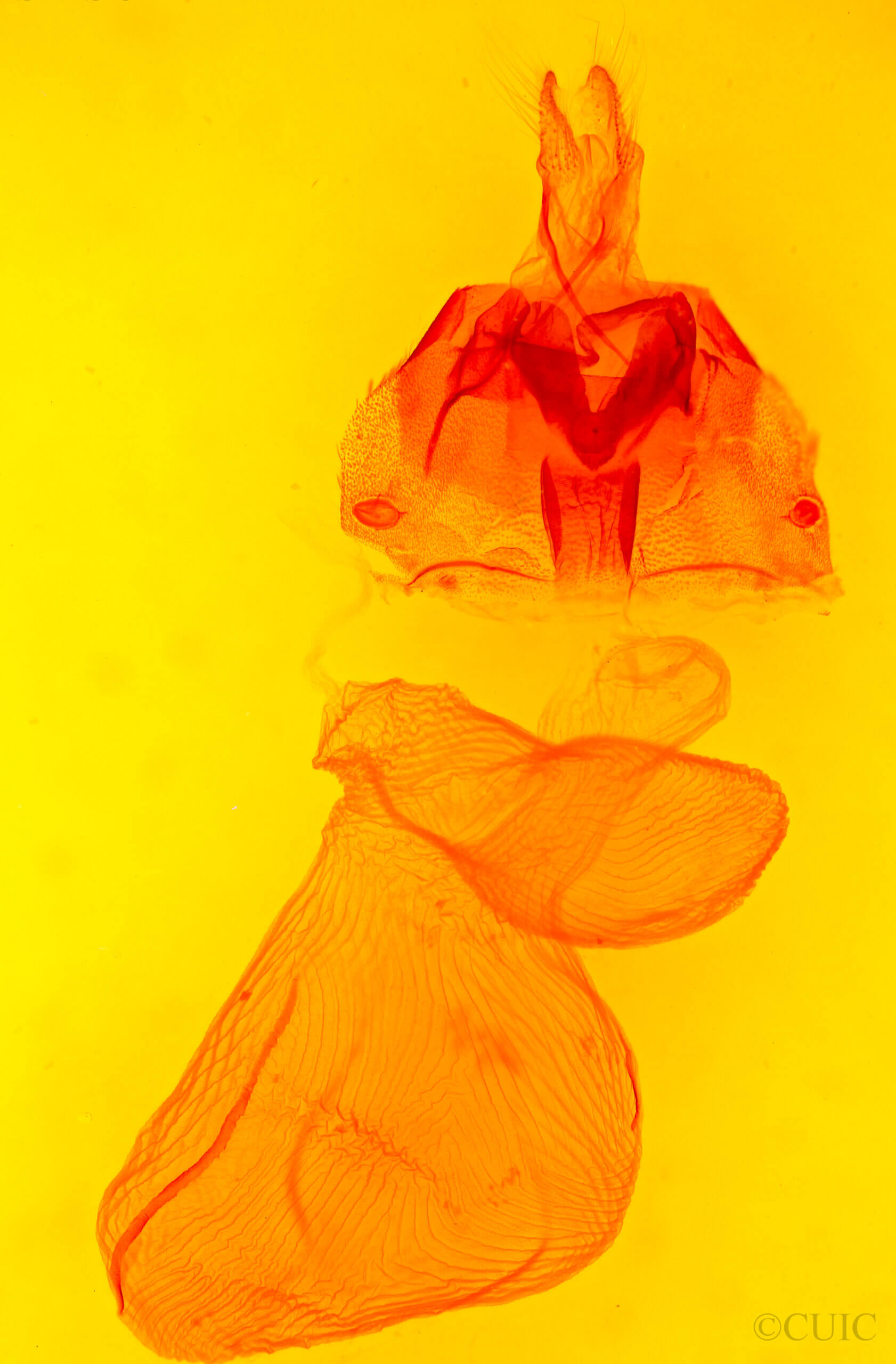 genitalia view of adult Xestia dolosa