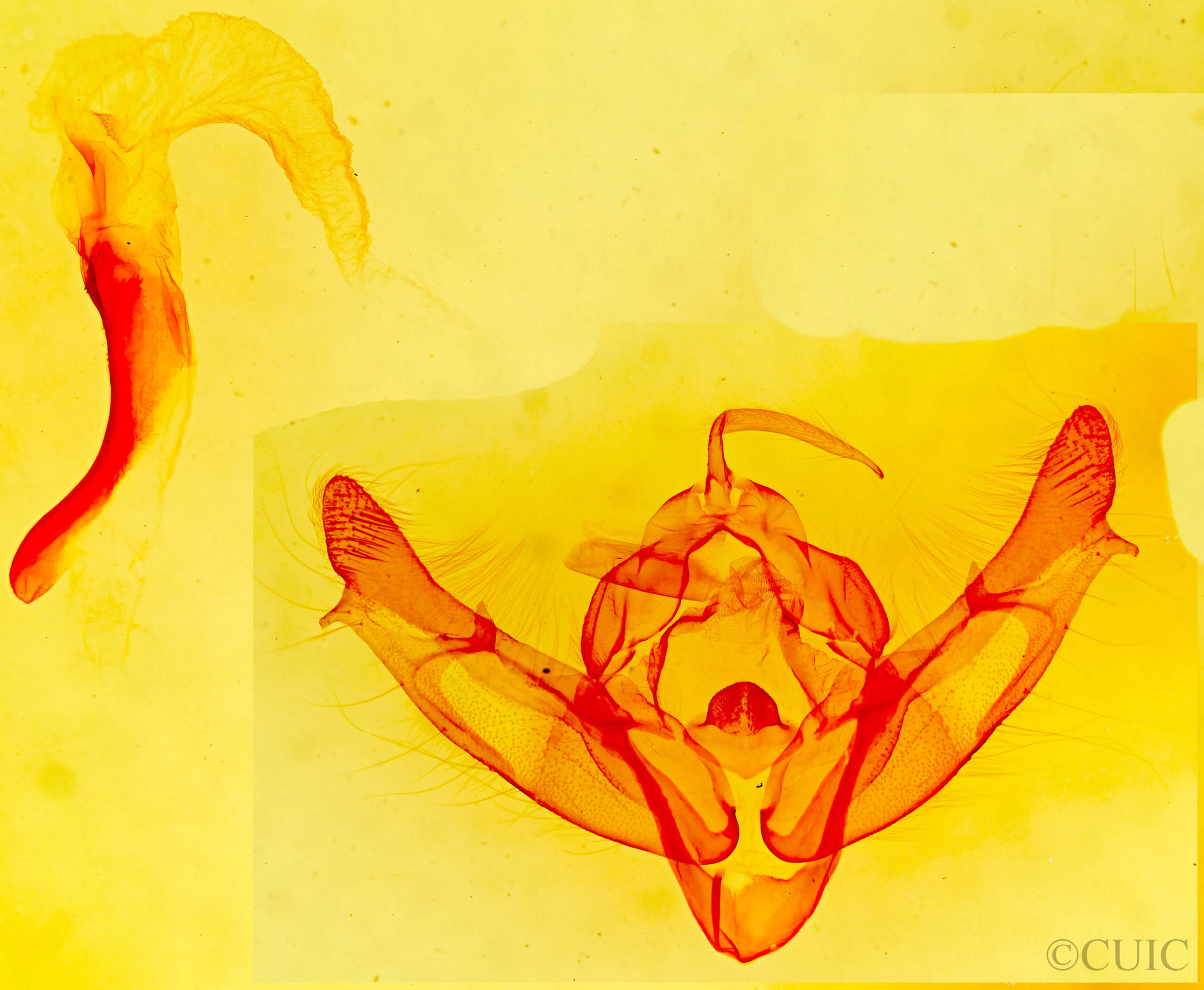 genitalia view of adult Xestia dolosa