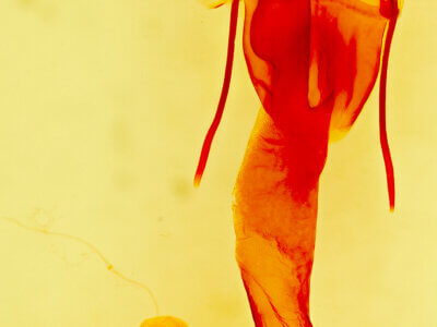 genitalia view of adult Lacinipolia acutipennis