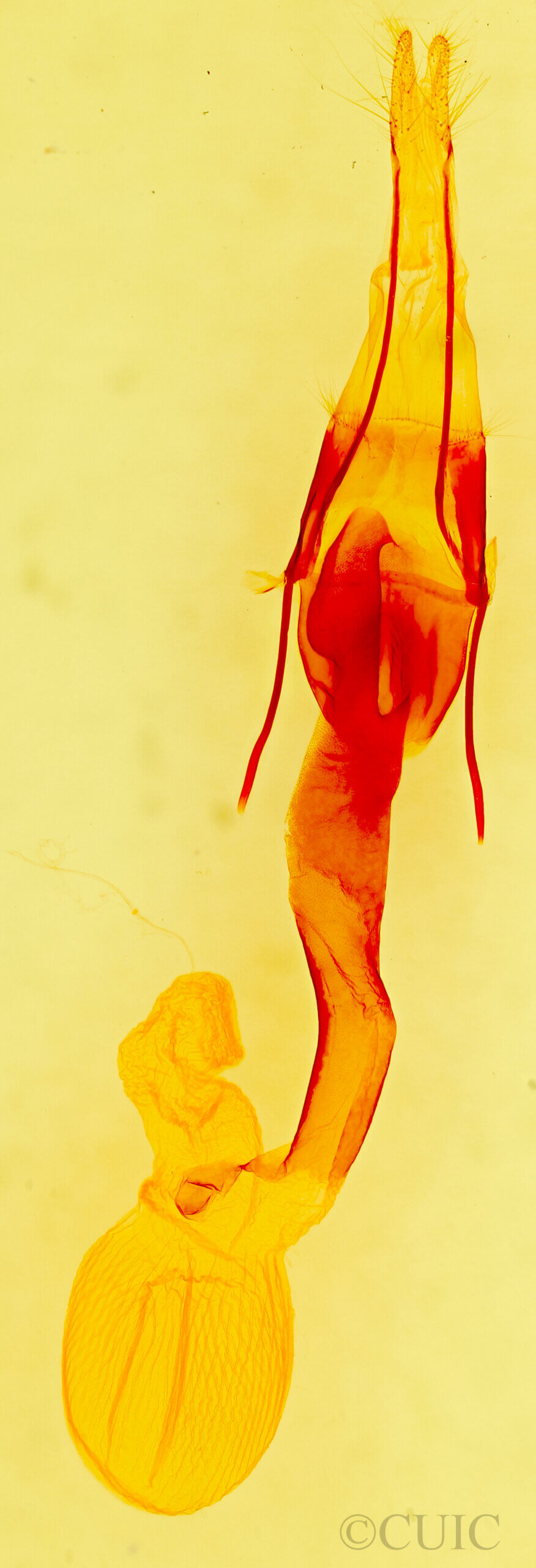 genitalia view of adult Lacinipolia acutipennis