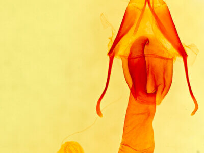 genitalia view of adult Lacinipolia acutipennis