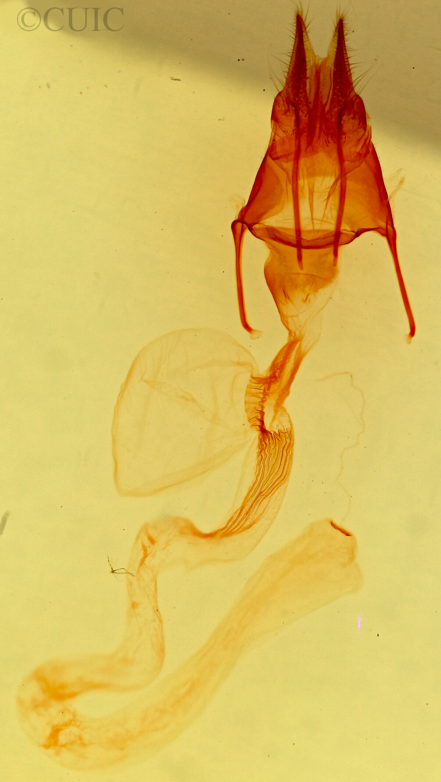 genitalia view of adult Hypotrix spinosa