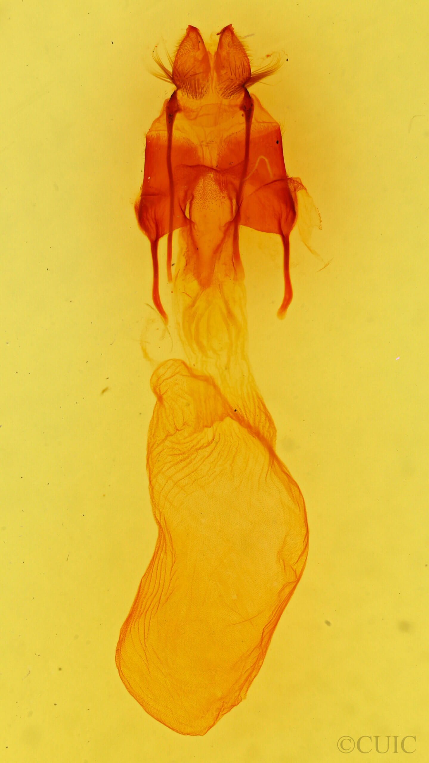 genitalia view of adult Euxoa vernalis