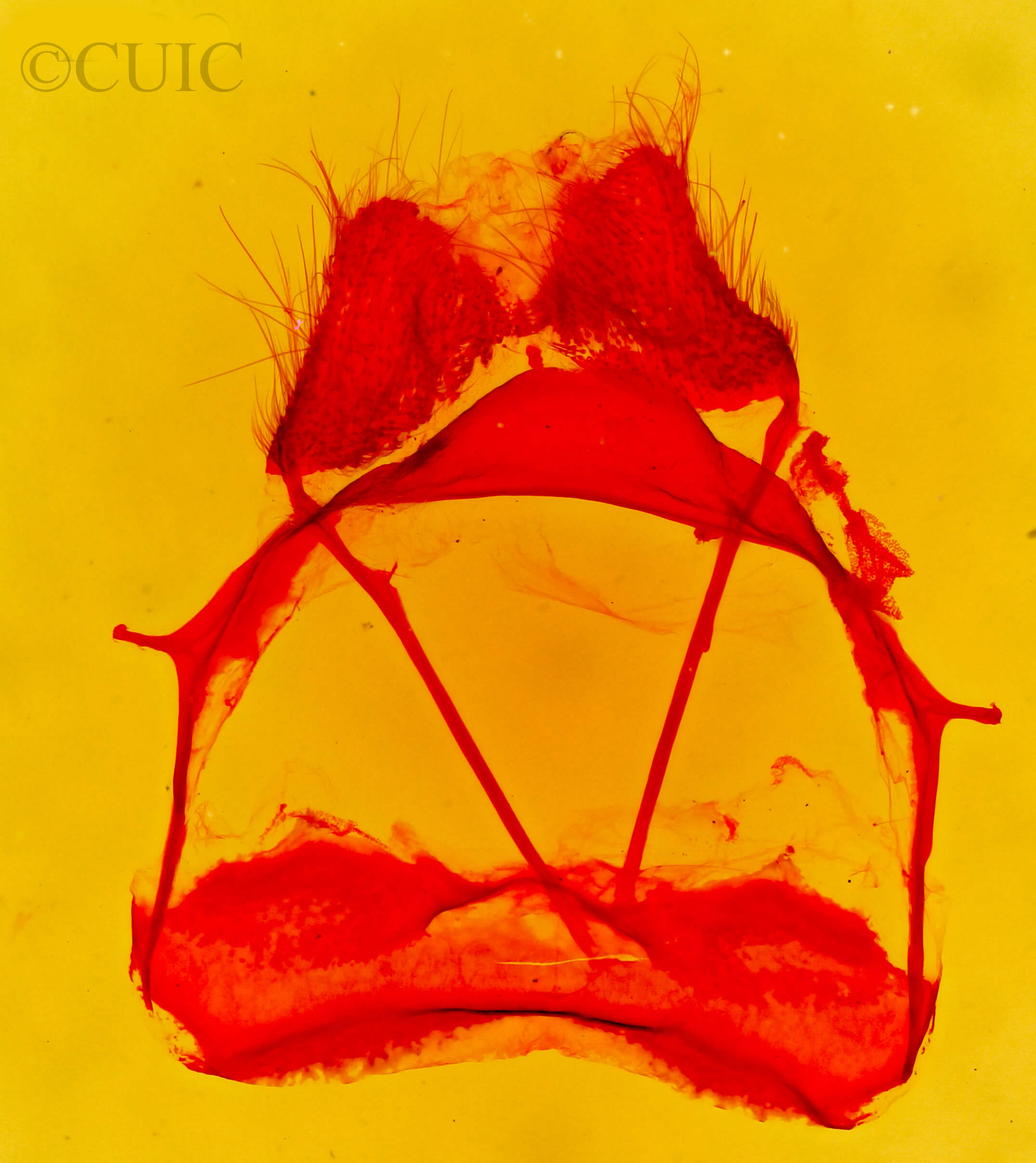 genitalia view of adult Tolype distincta